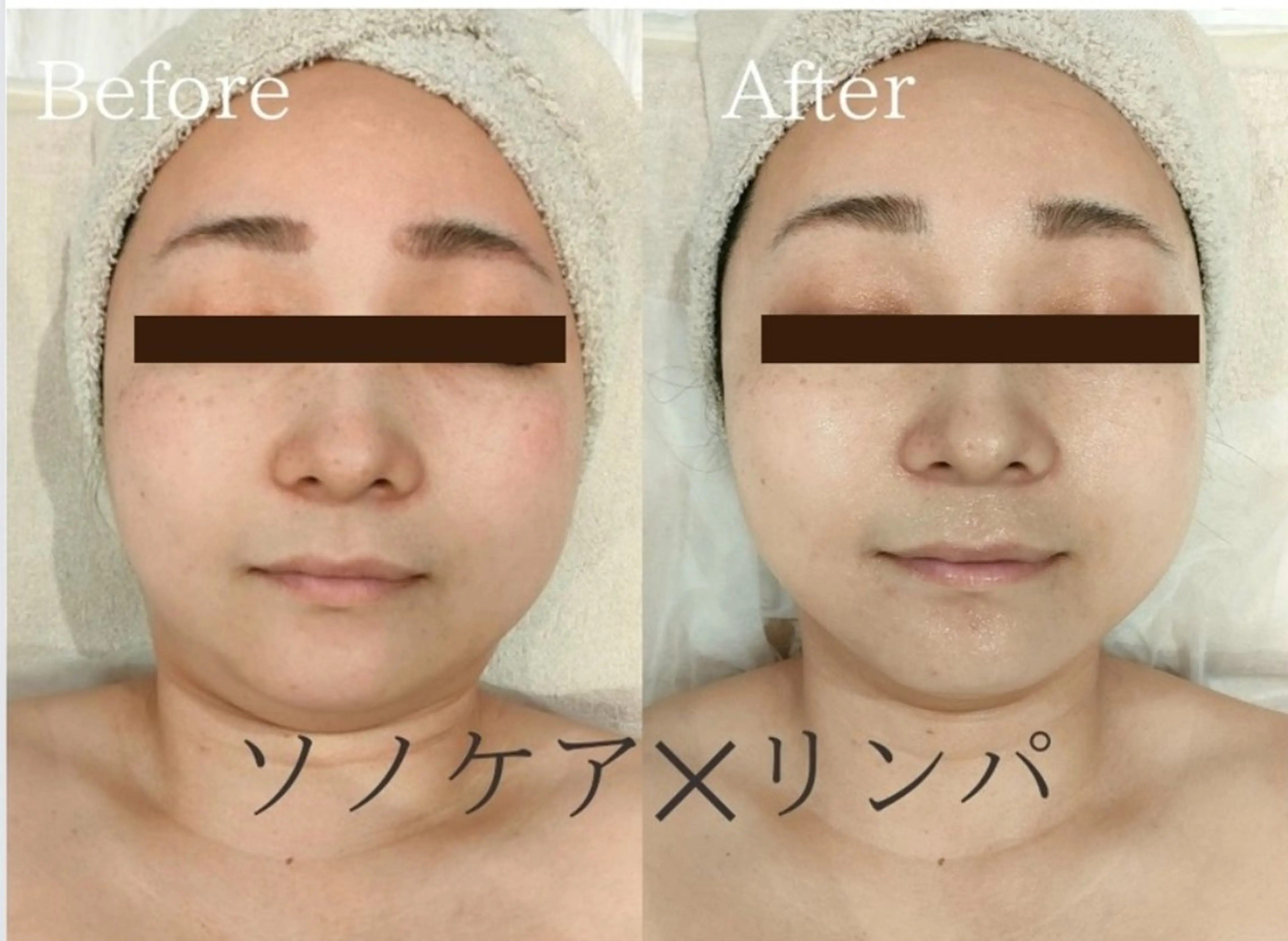 美肌脱毛&小顔・フェ イシャル【SONA】のエステ・リラクイメージ