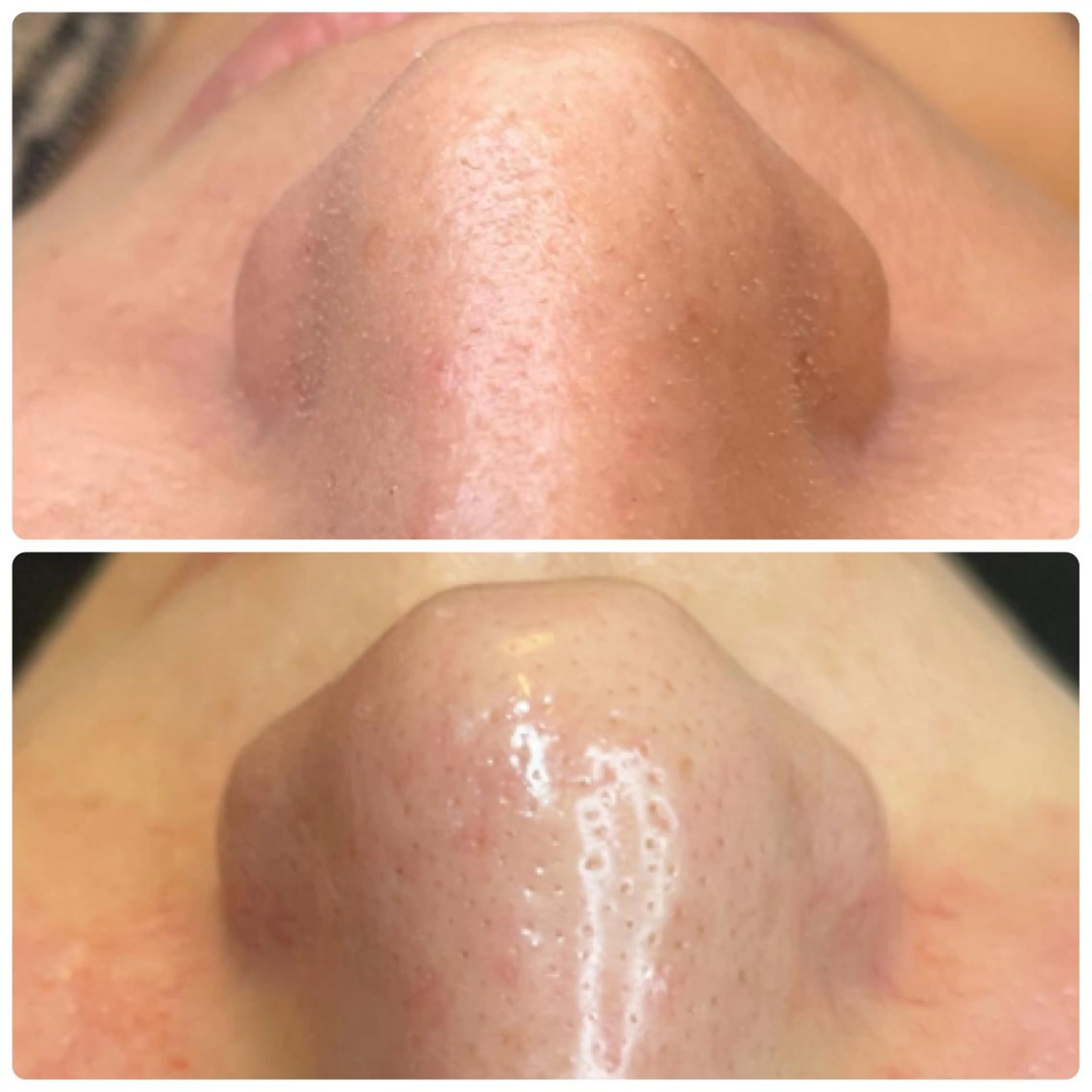 TT Beauty所属・TT Beautyの眉毛・アイブロウイメージ