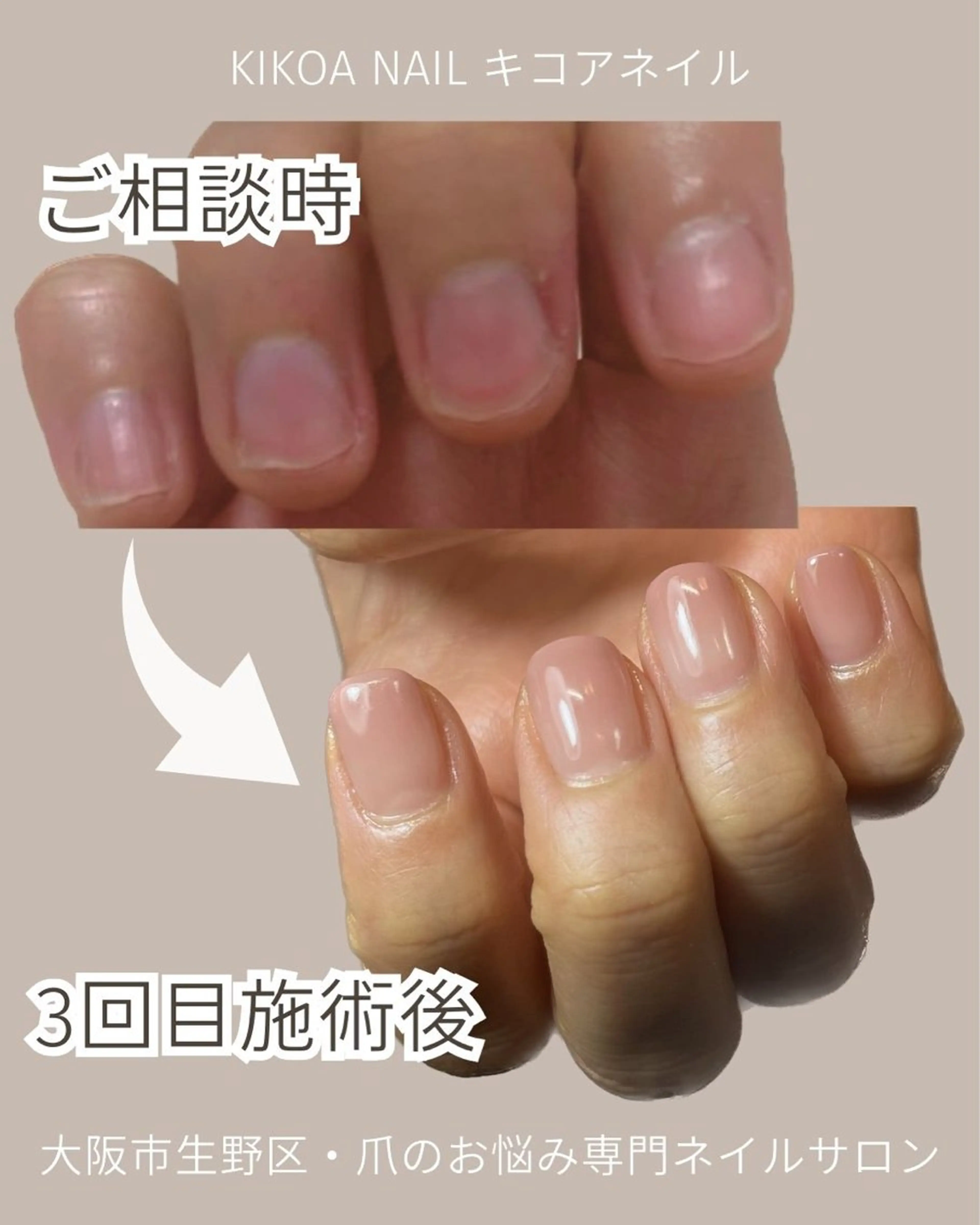 ネイル KIKOA NAIL キコアネイルのネイルデザイン