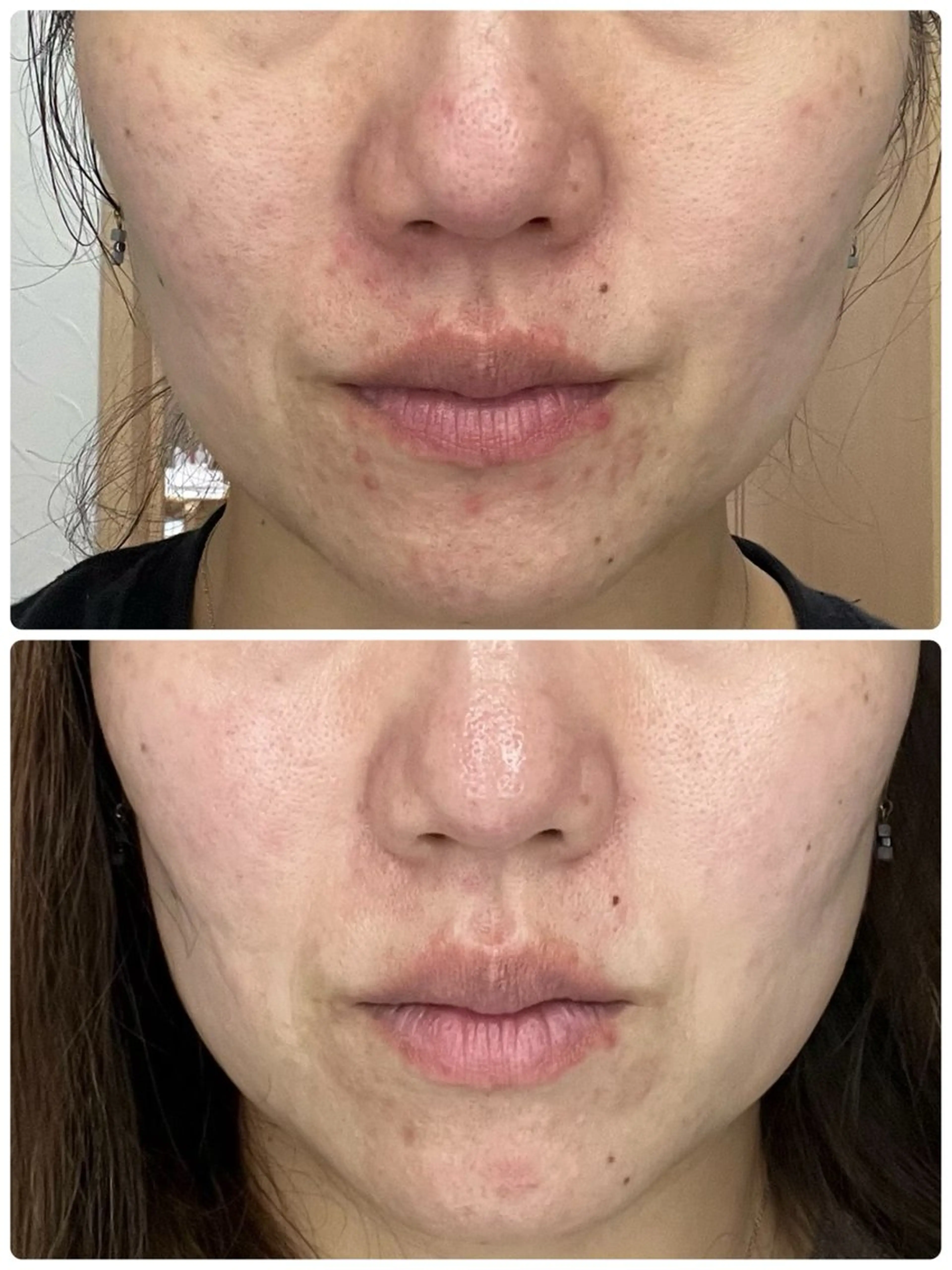 いおもり あやかのエステ・リラクイメージ