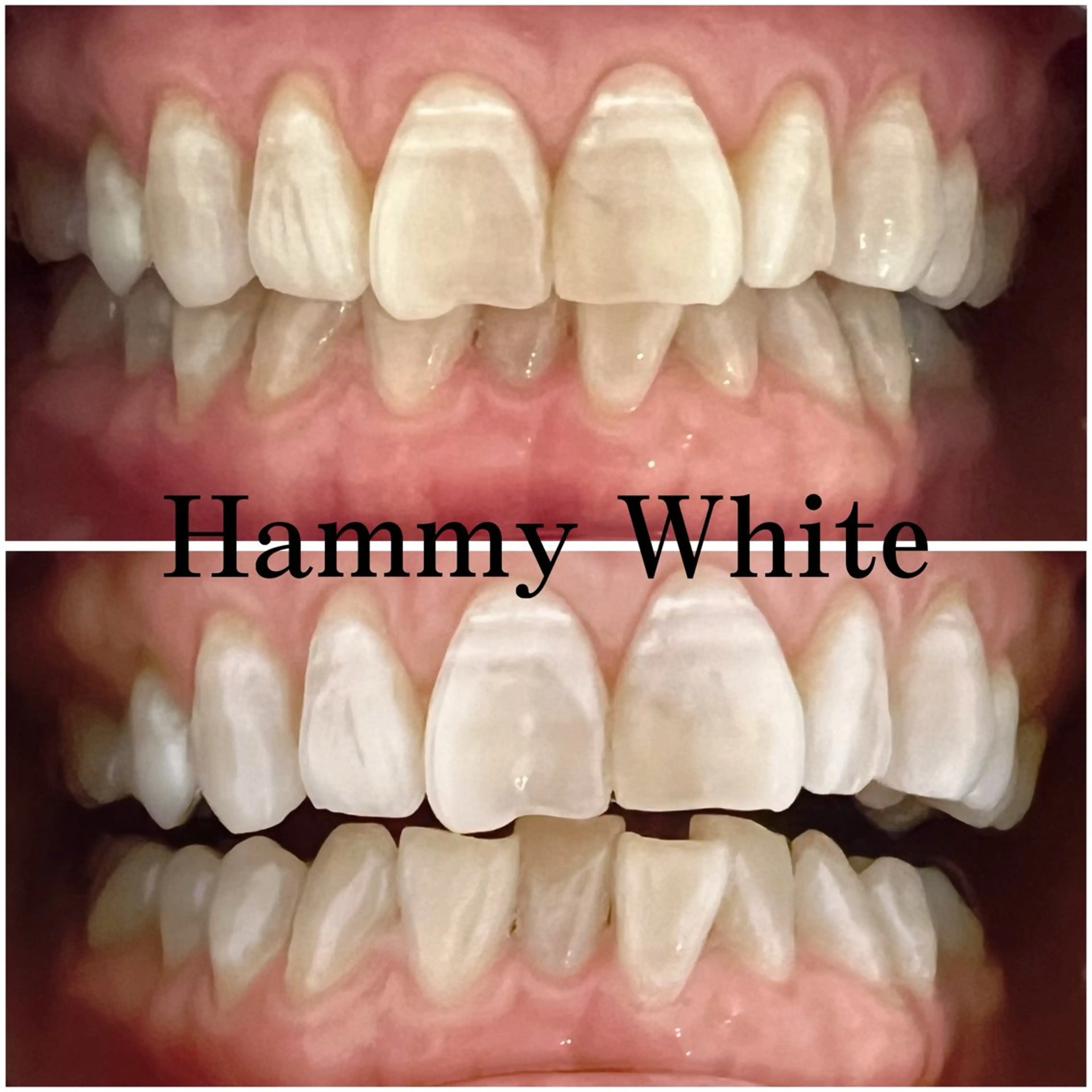 その他 HammyWhite 心斎橋🌈AMIのその他イメージ