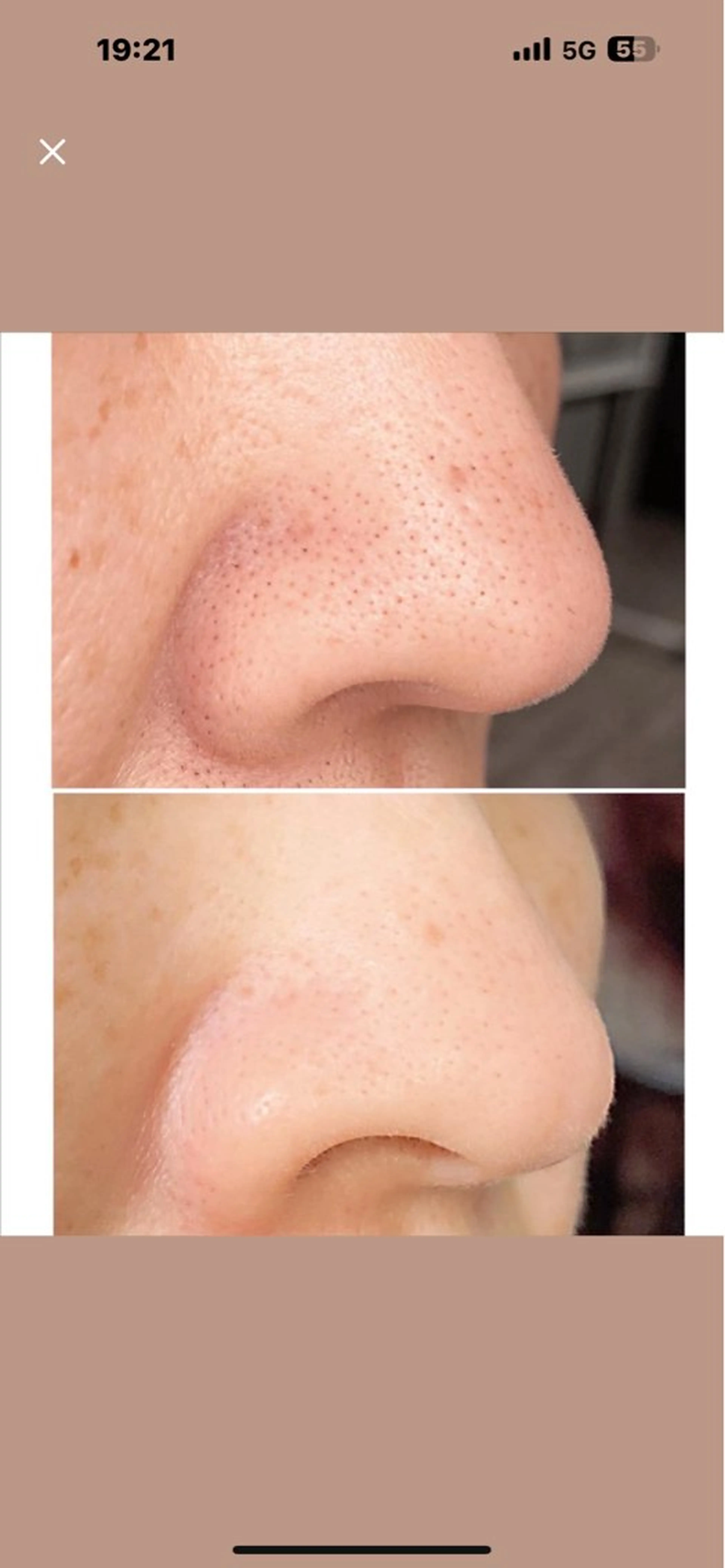 エステ 韓国肌管理🇰🇷 nanaのエステ・リラクイメージ