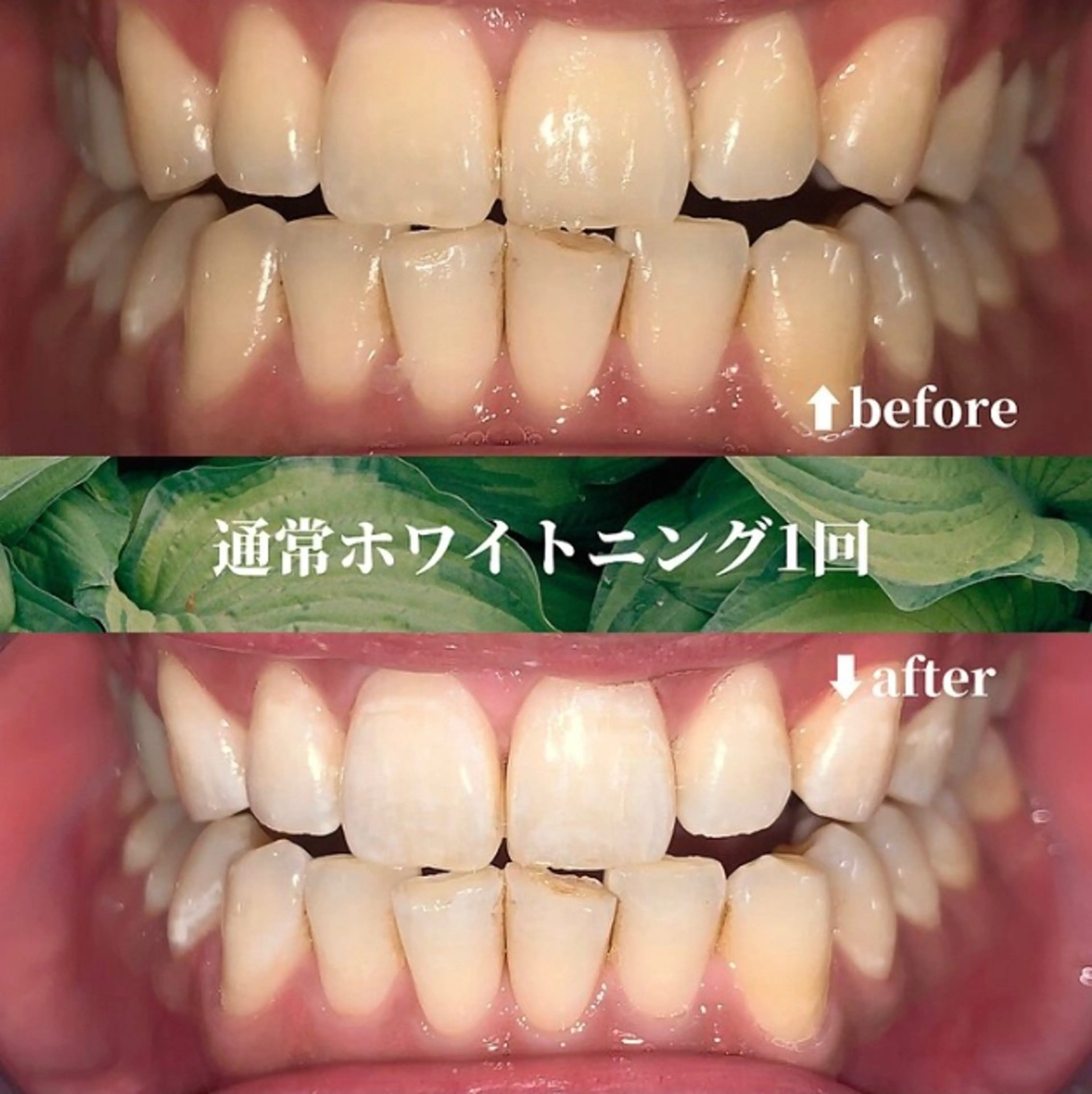 メンズ エステ futaba ホワイトニング/天神のエステ・リラクイメージ