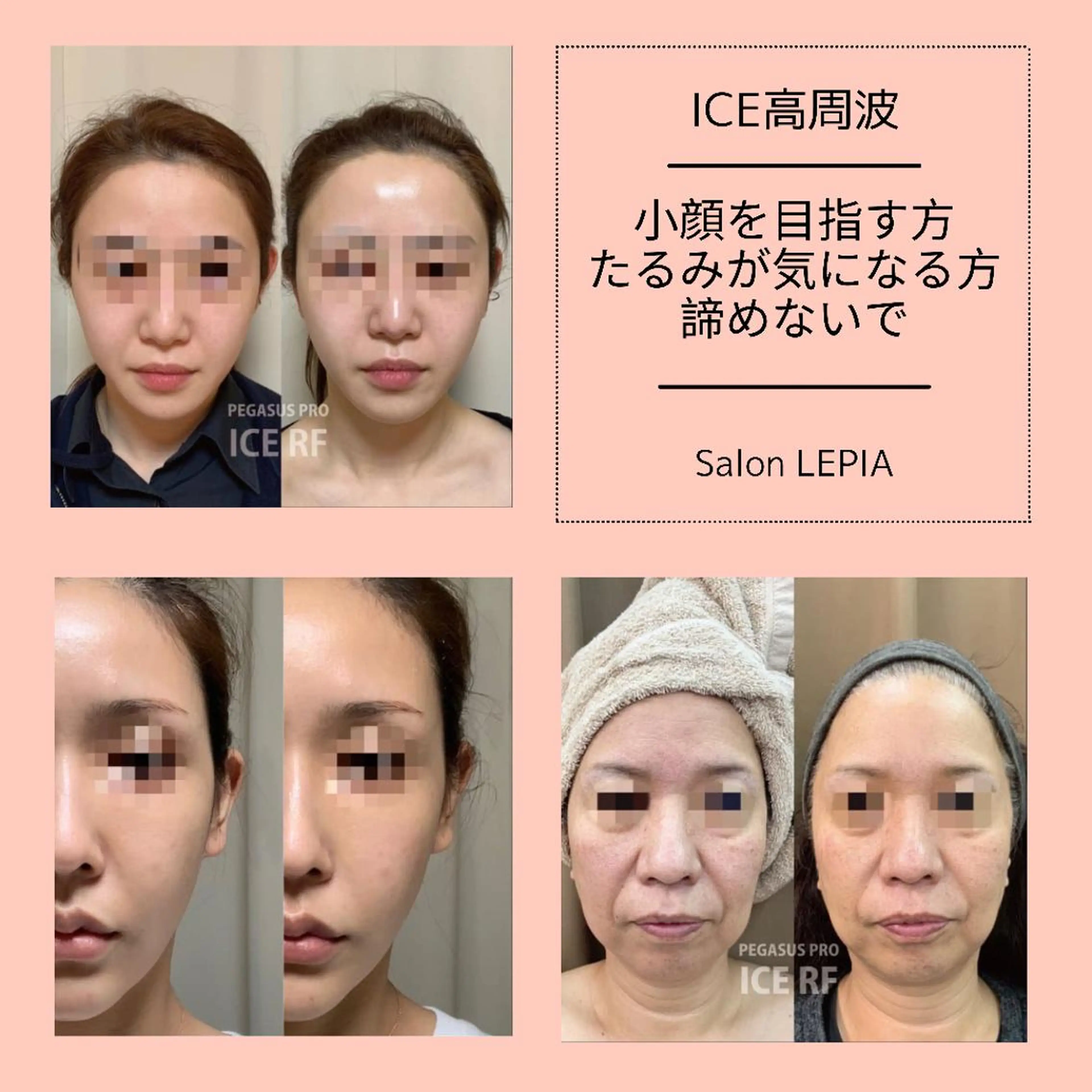 男女同額完全個室脱毛 LEPIA内田のエステ・リラクイメージ