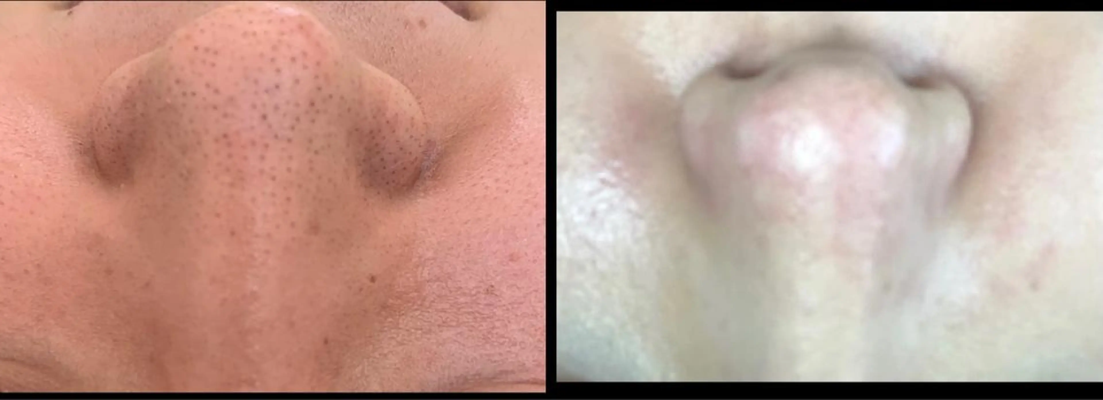 メンズ マツエク・マツパ ヘアエステSUIL   by SweetRoom所属・大倉 るるなのエステ・リラクイメージ