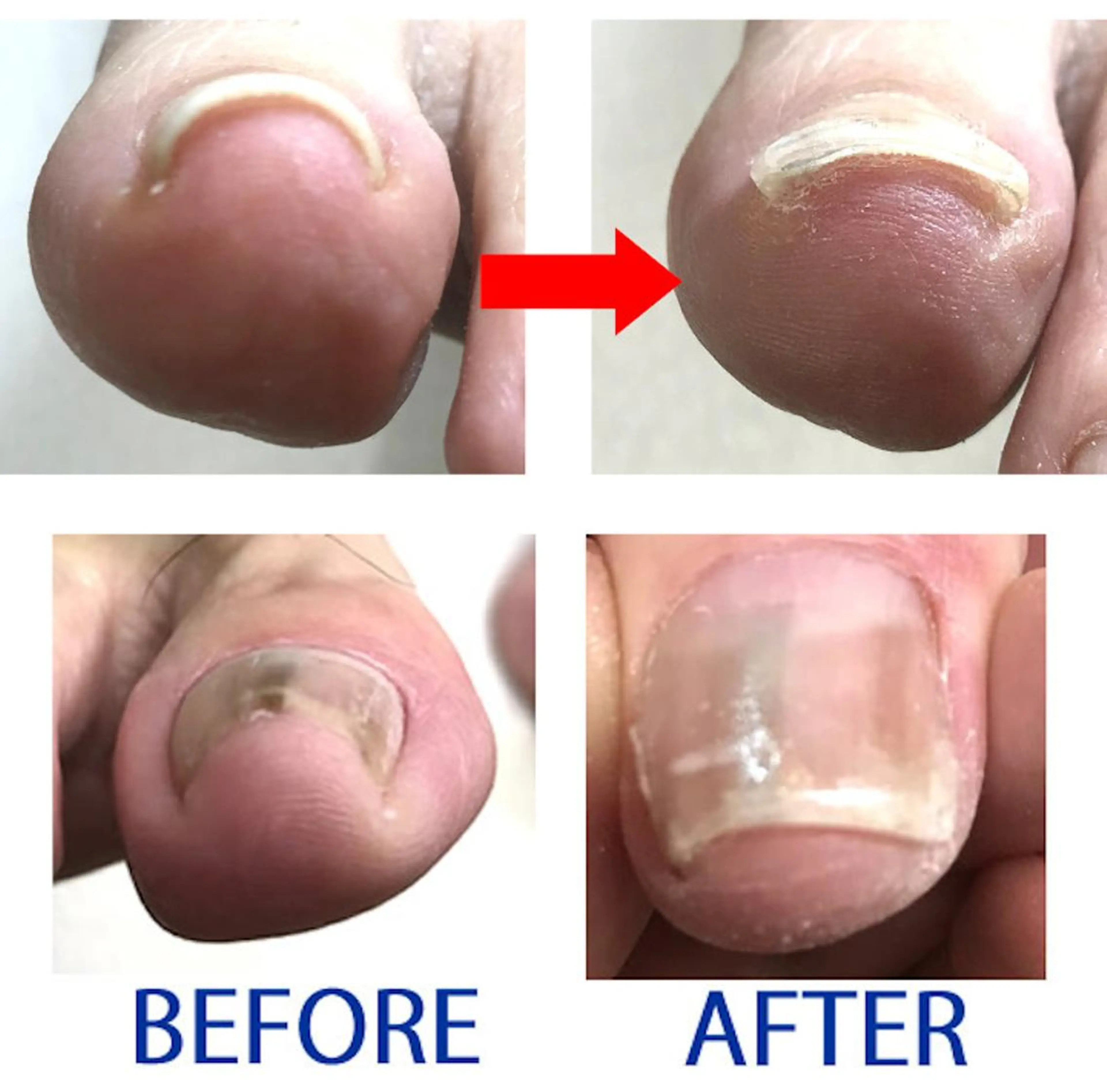 ネイル クリアネイル ジェルネイル イワサキ  のネイルデザイン