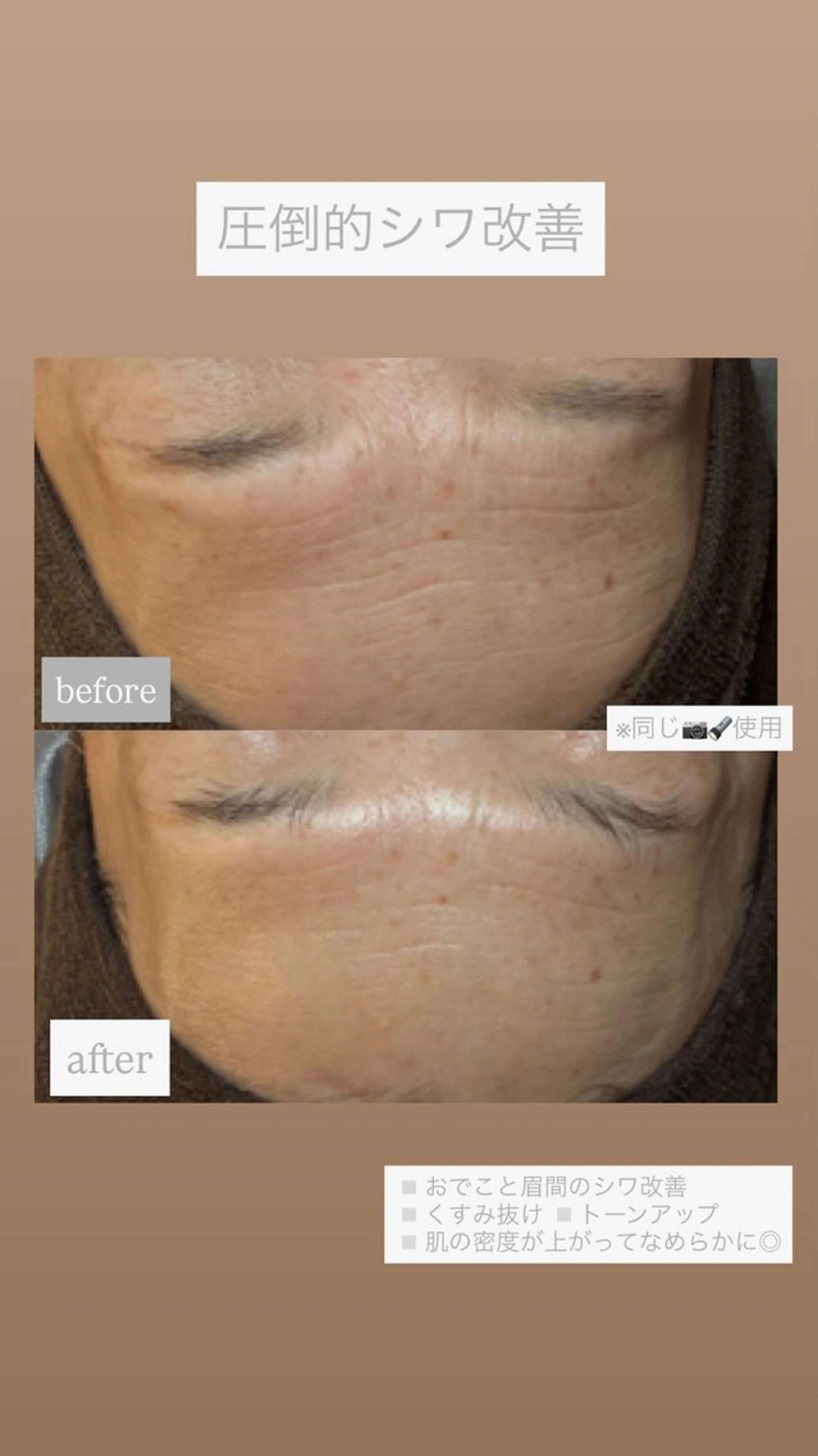 chouchou【シュシュ】所属・トータルボディケア chouchouのエステ・リラクイメージ