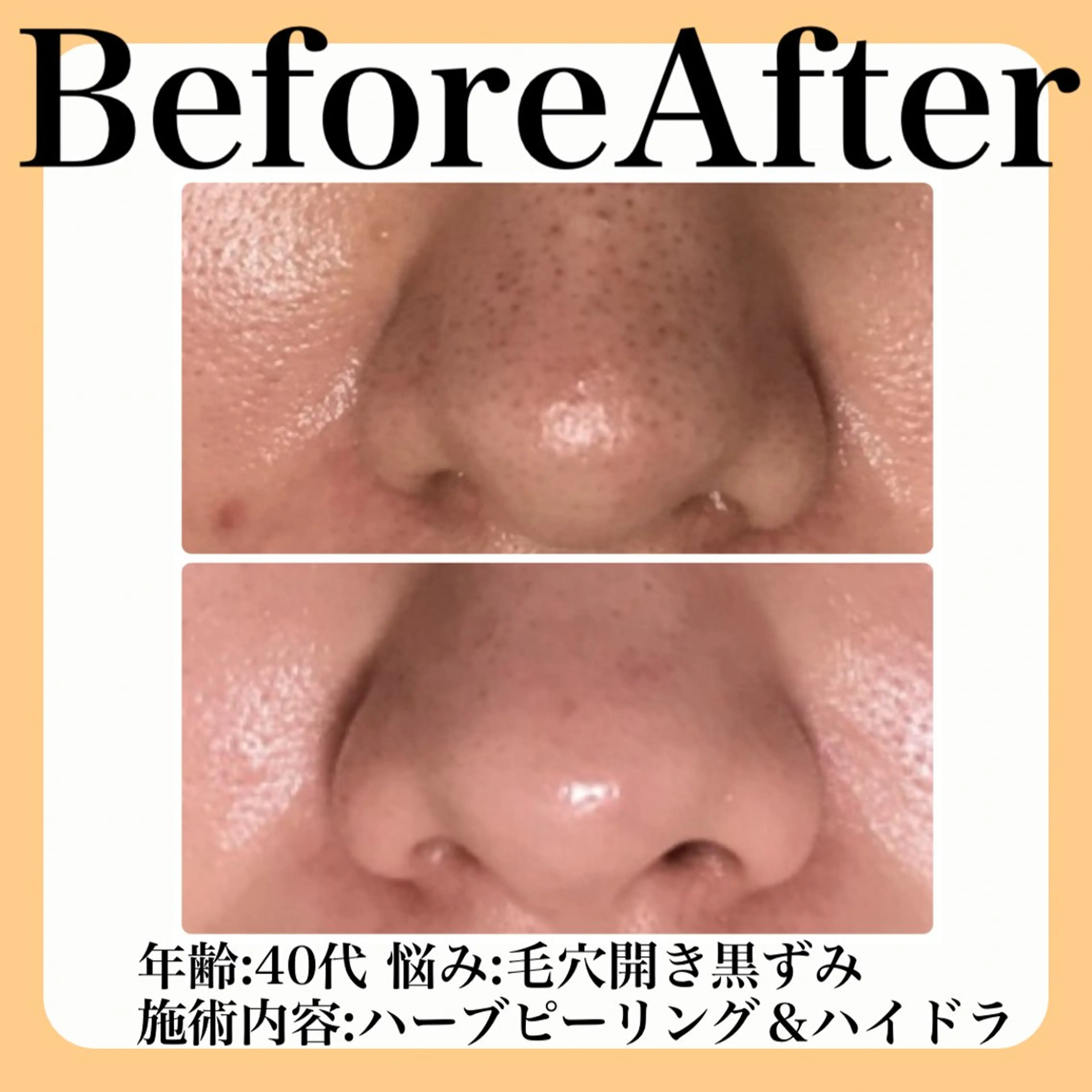 エステ 毛穴・たるみ･ニキビケア専門サロンsui所属・sui【スイ】 ARISAのエステ・リラクイメージ