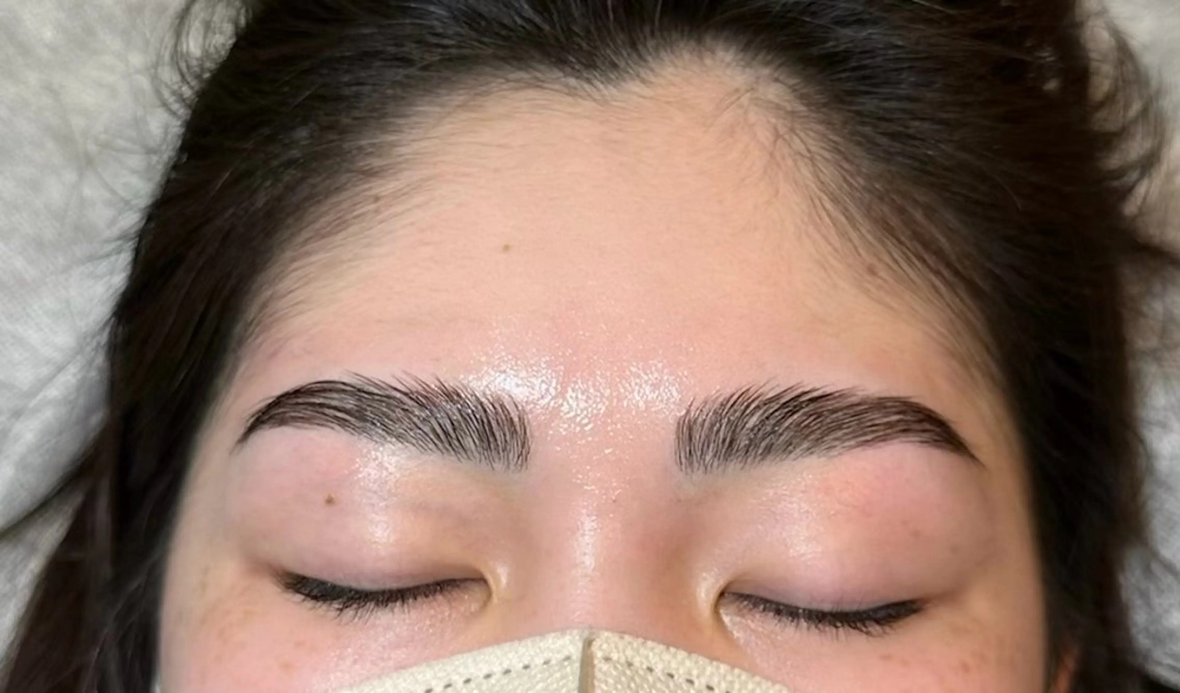 HBL（ハリウッドブロウリフト）の写真