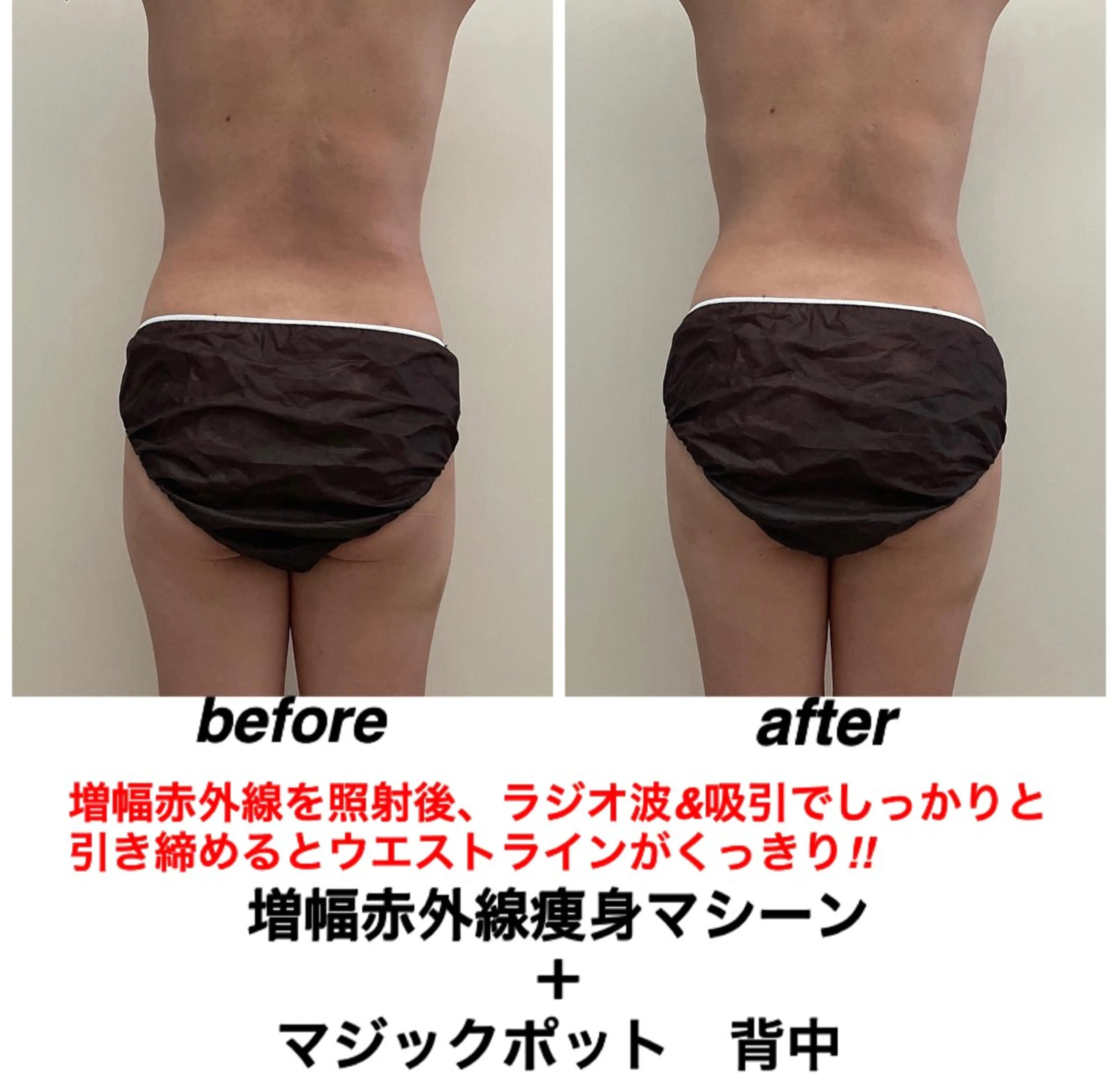 エステ ネイル・エステサロンUILANI所属・ネイル・エステサロン UILANIのネイルデザイン