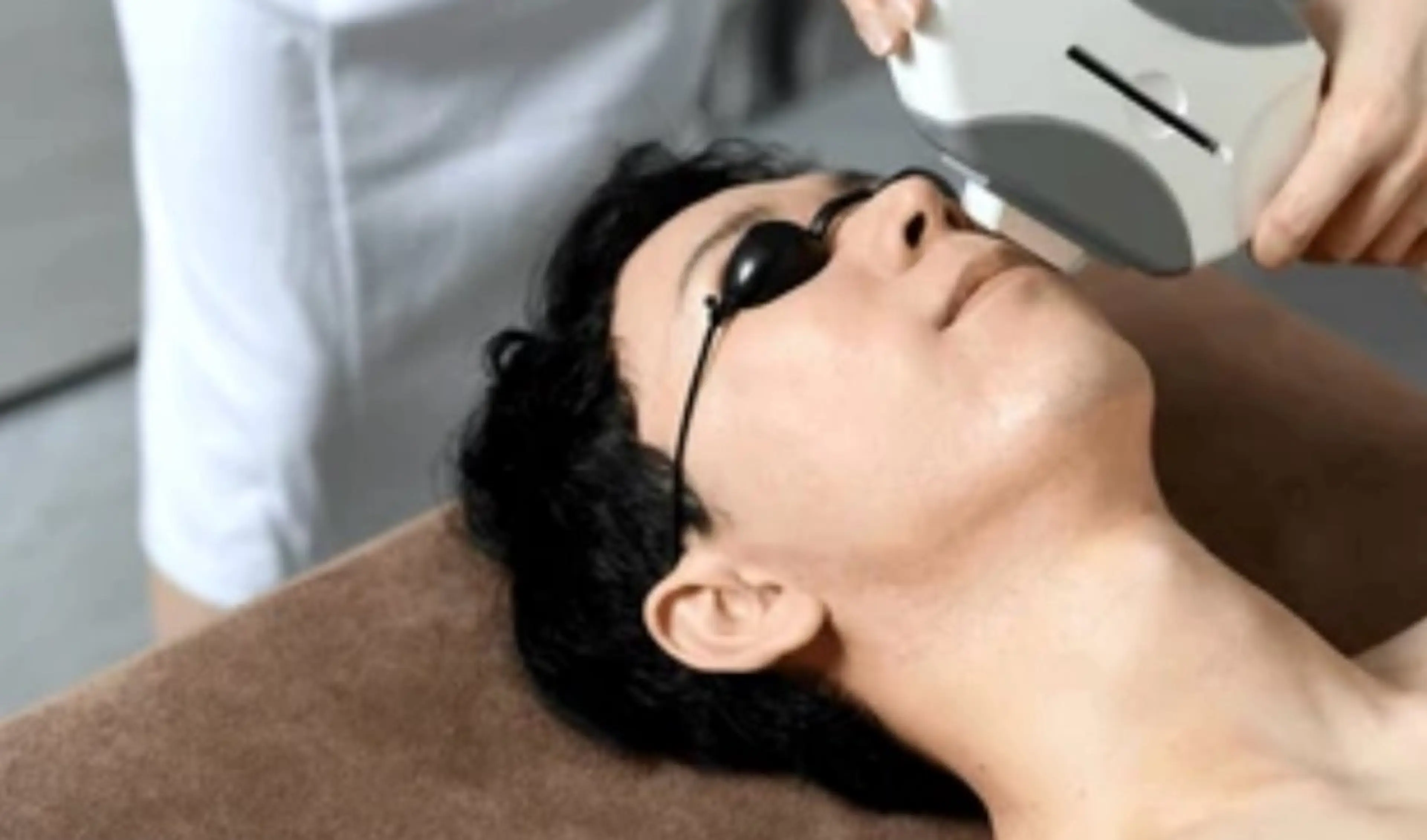 【メンズ脱毛】ヒゲ全体の写真