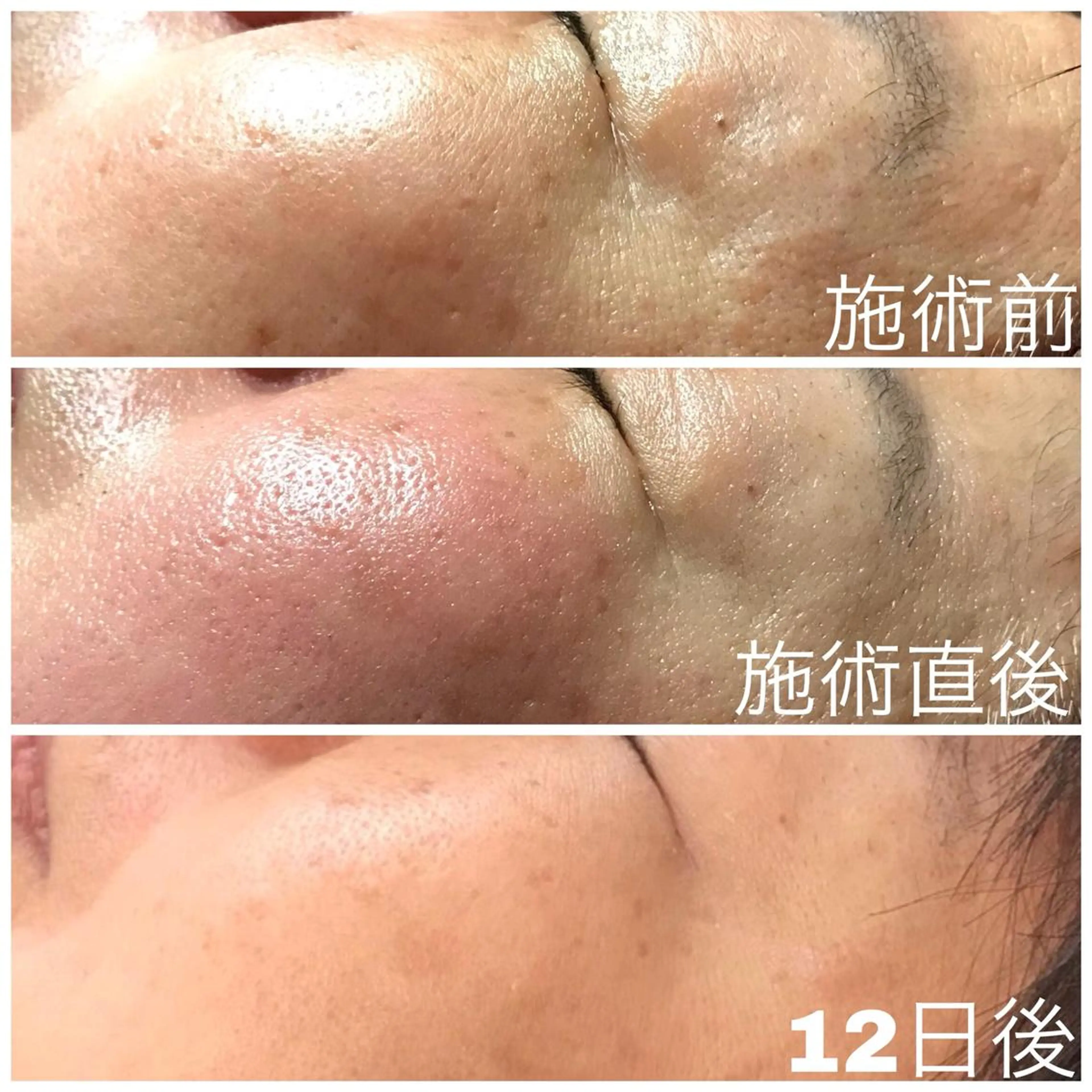 エステ 舟橋 優衣のエステ・リラクイメージ