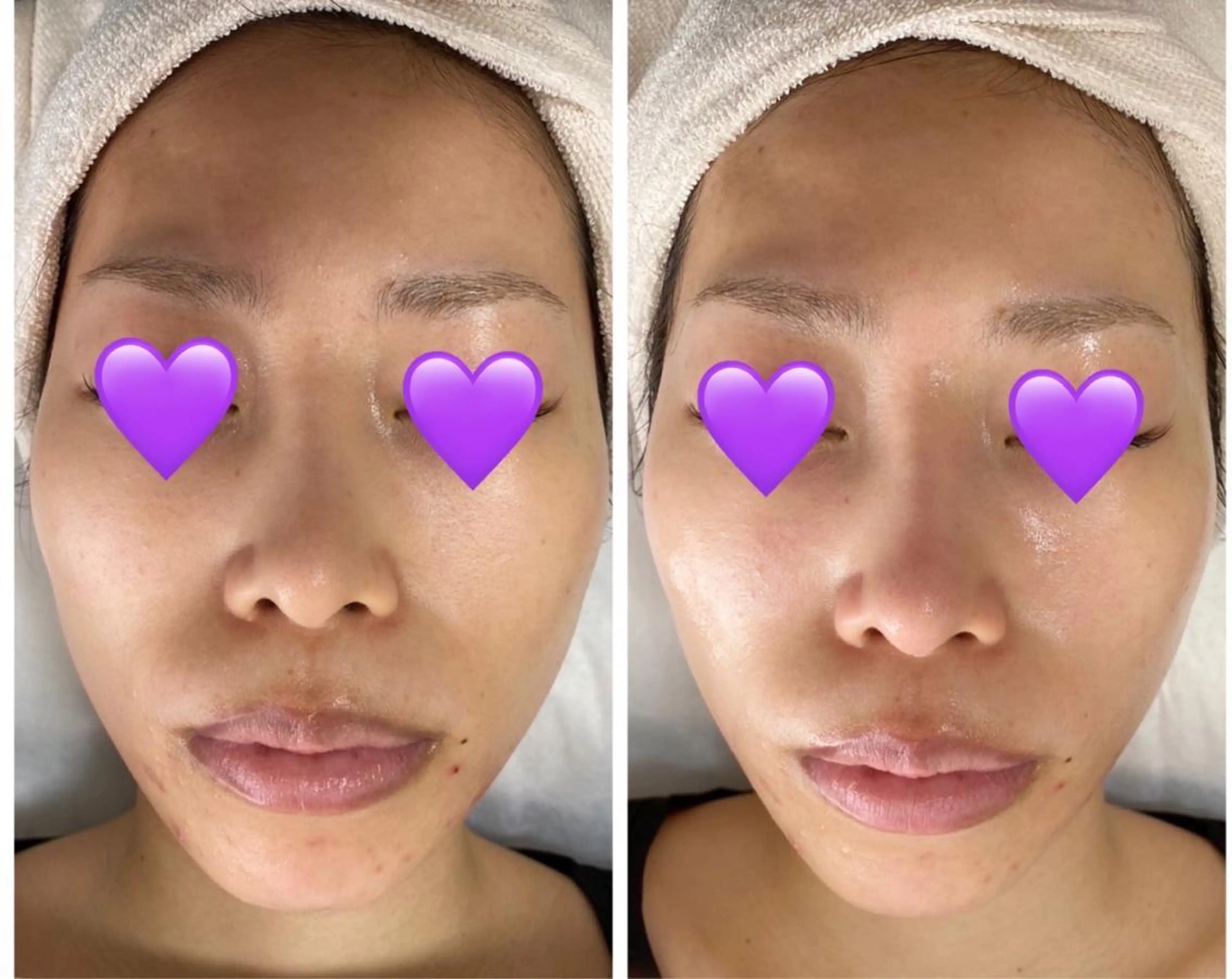 De I'm トータルビューティーサロン所属・COCO beautyサロンのエステ・リラクイメージ