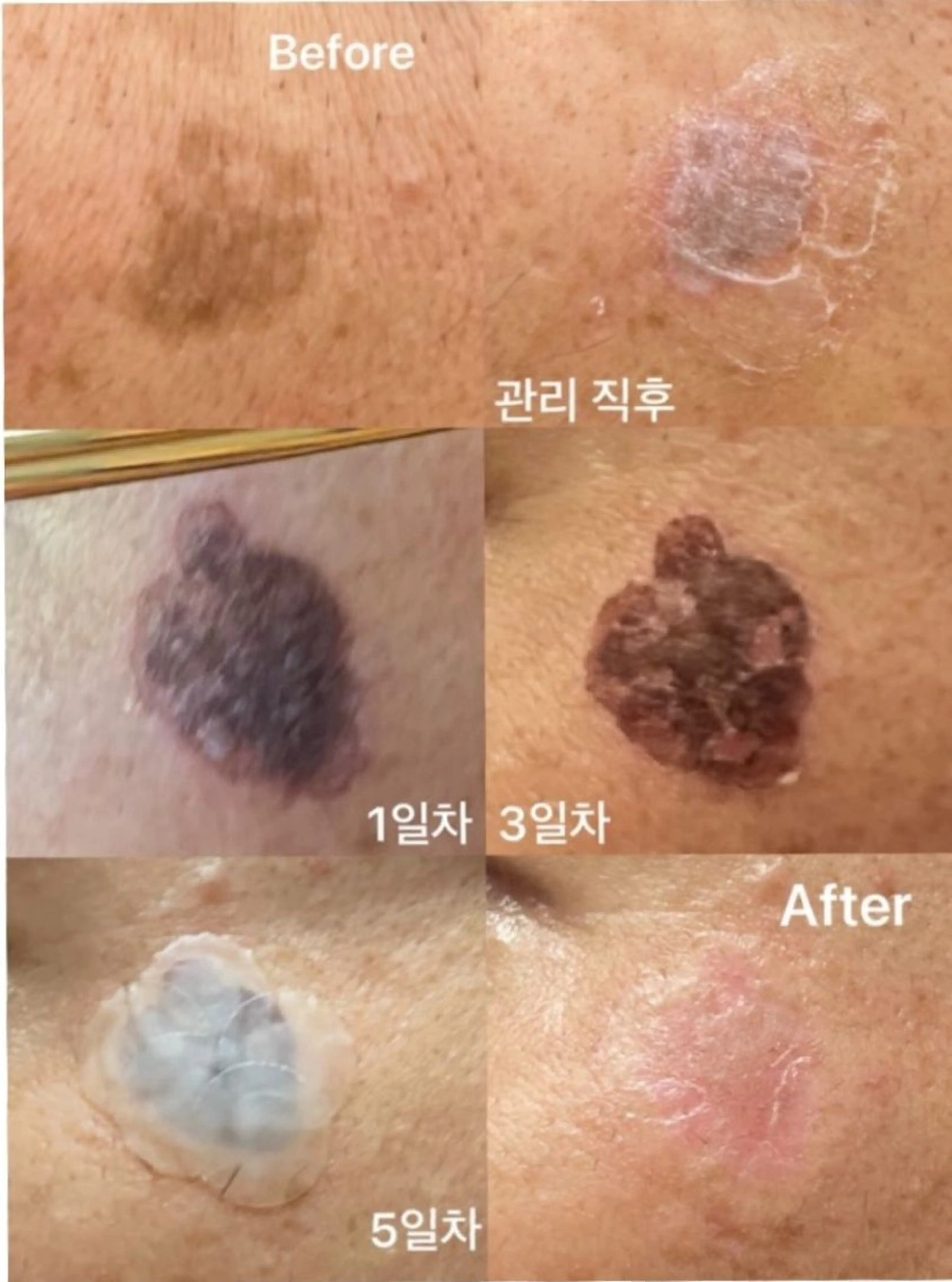 肌改善グリーンピール 東川口/浦和美園のエステ・リラクイメージ