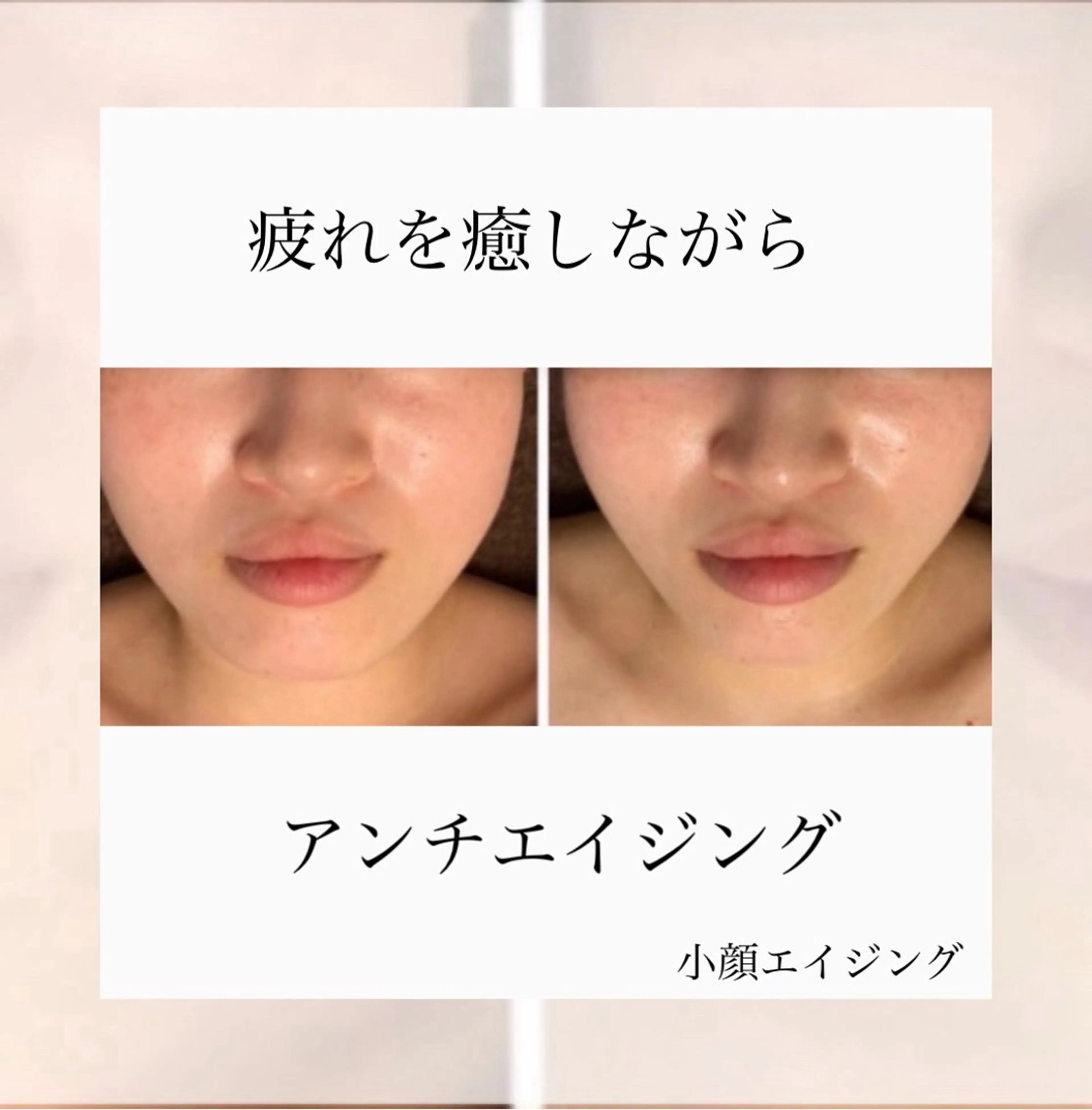 🥉小顔リフトアップコース50分の写真