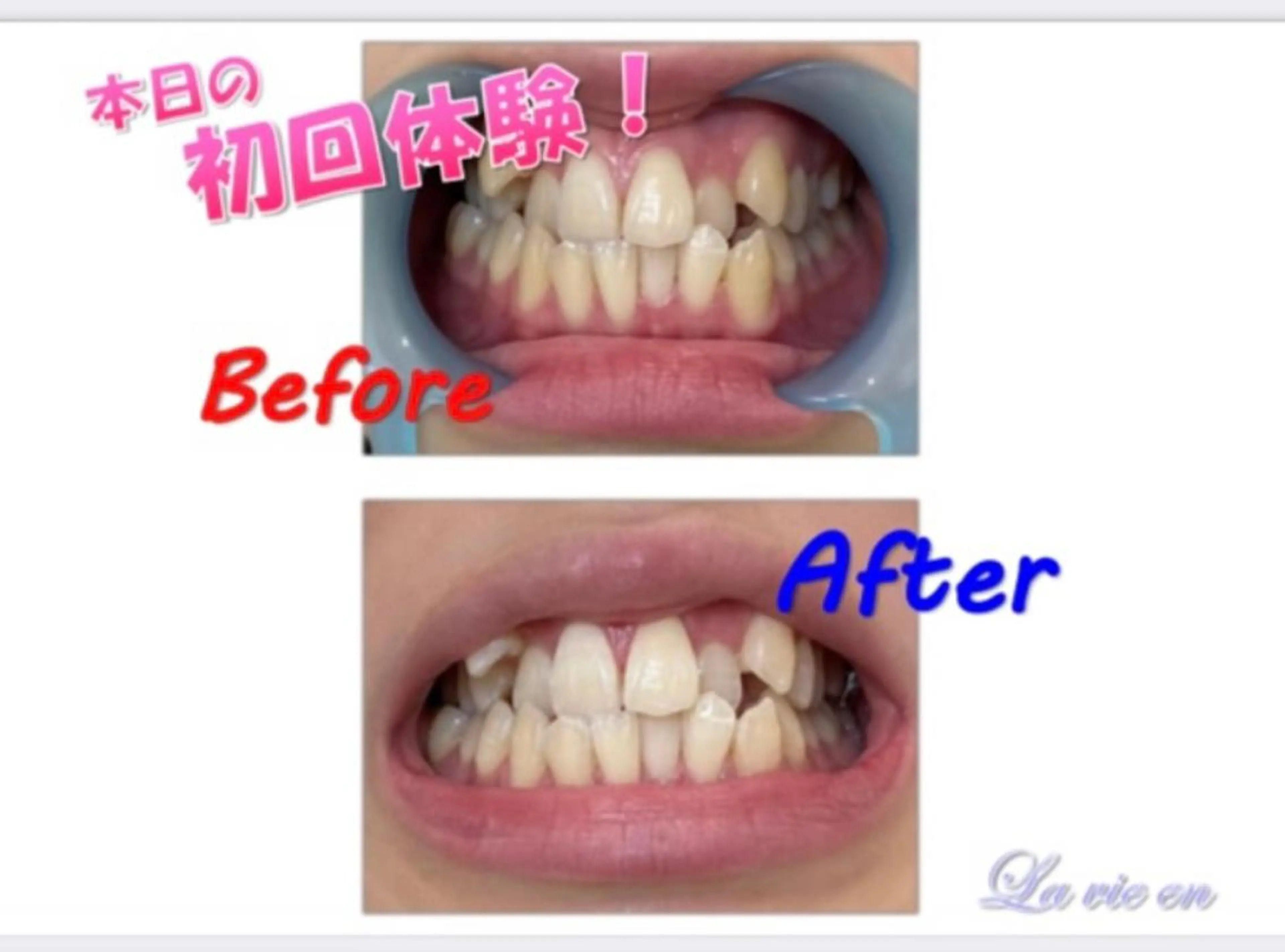 その他 セルフホワイトニングサロン　ラヴィアン所属・ホワイトニングサロン La vie enのその他イメージ