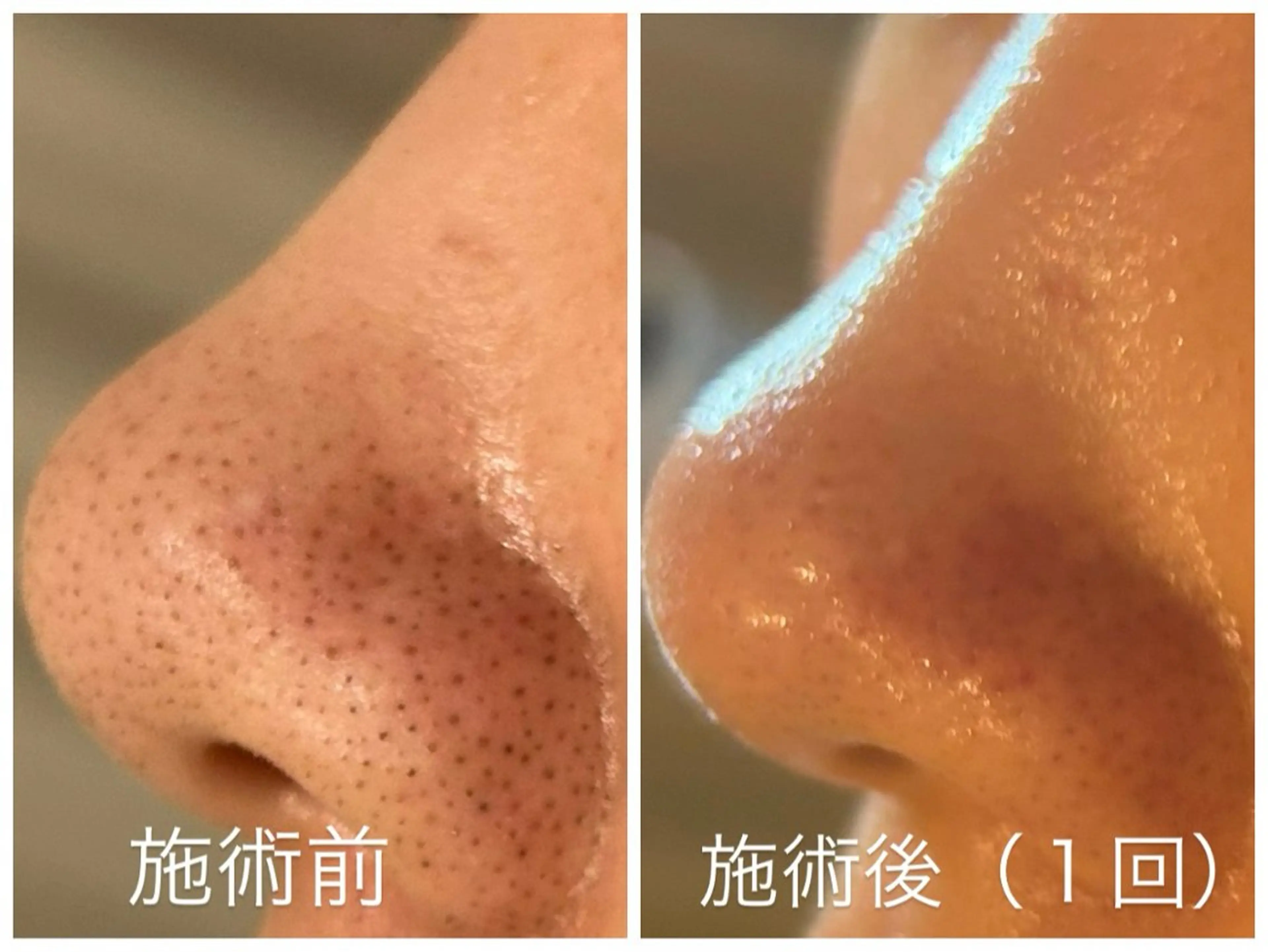 【都度払い脱毛 美肌脱毛】馬車道店のエステ・リラクイメージ