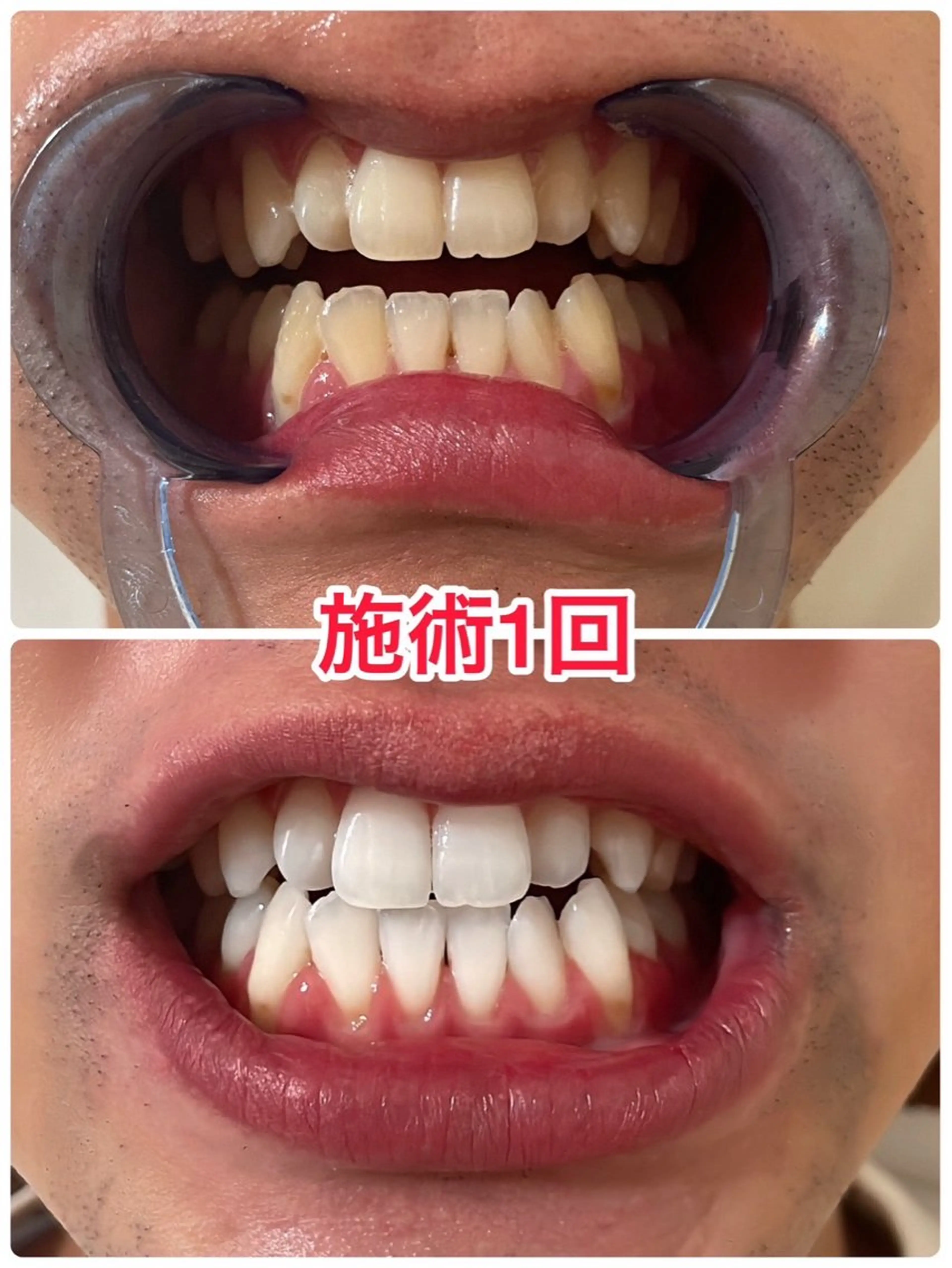 その他 Luana武蔵小杉店 (ルアナ)のエステ・リラクイメージ