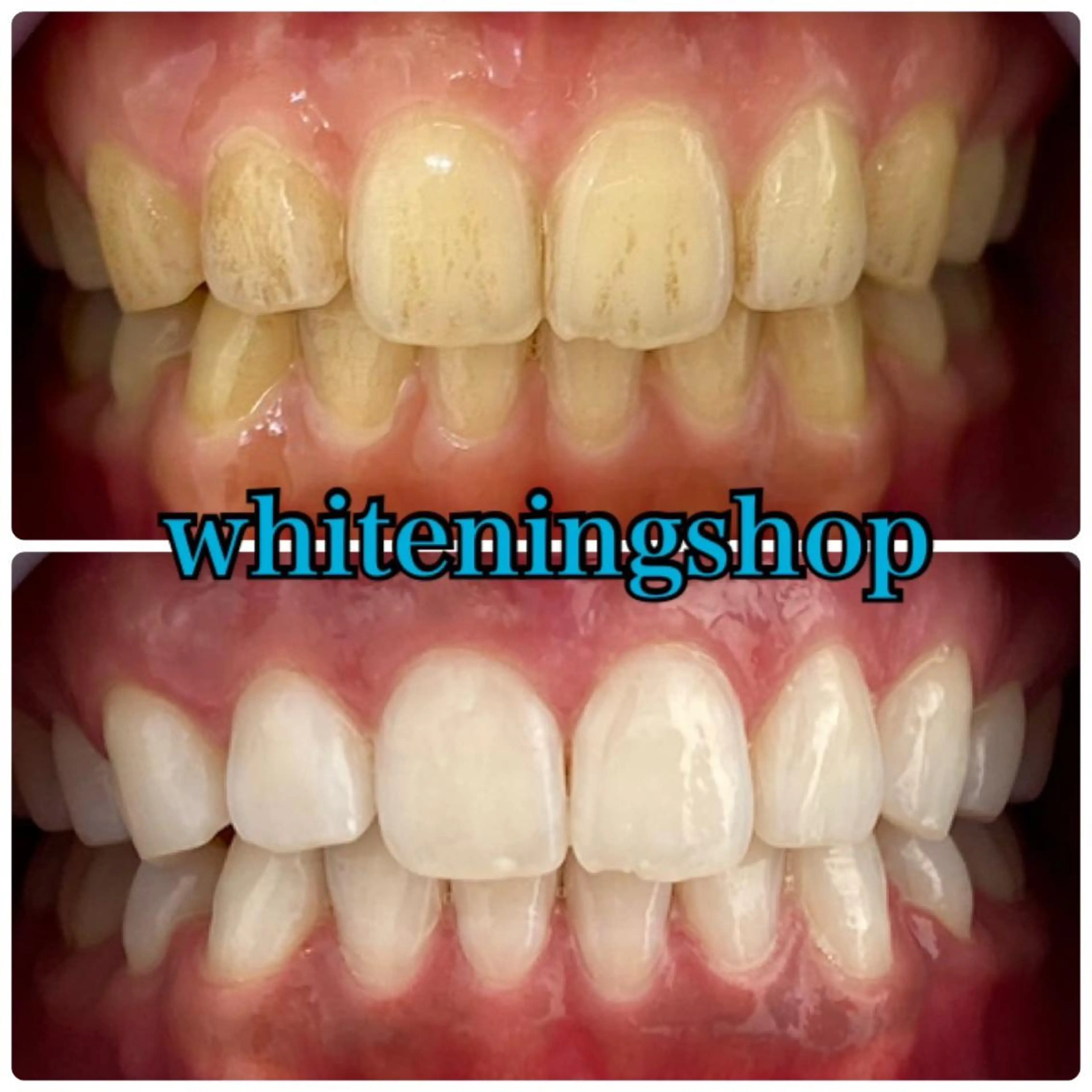 ホワイトニング ショップ吉祥寺店のエステ・リラクイメージ