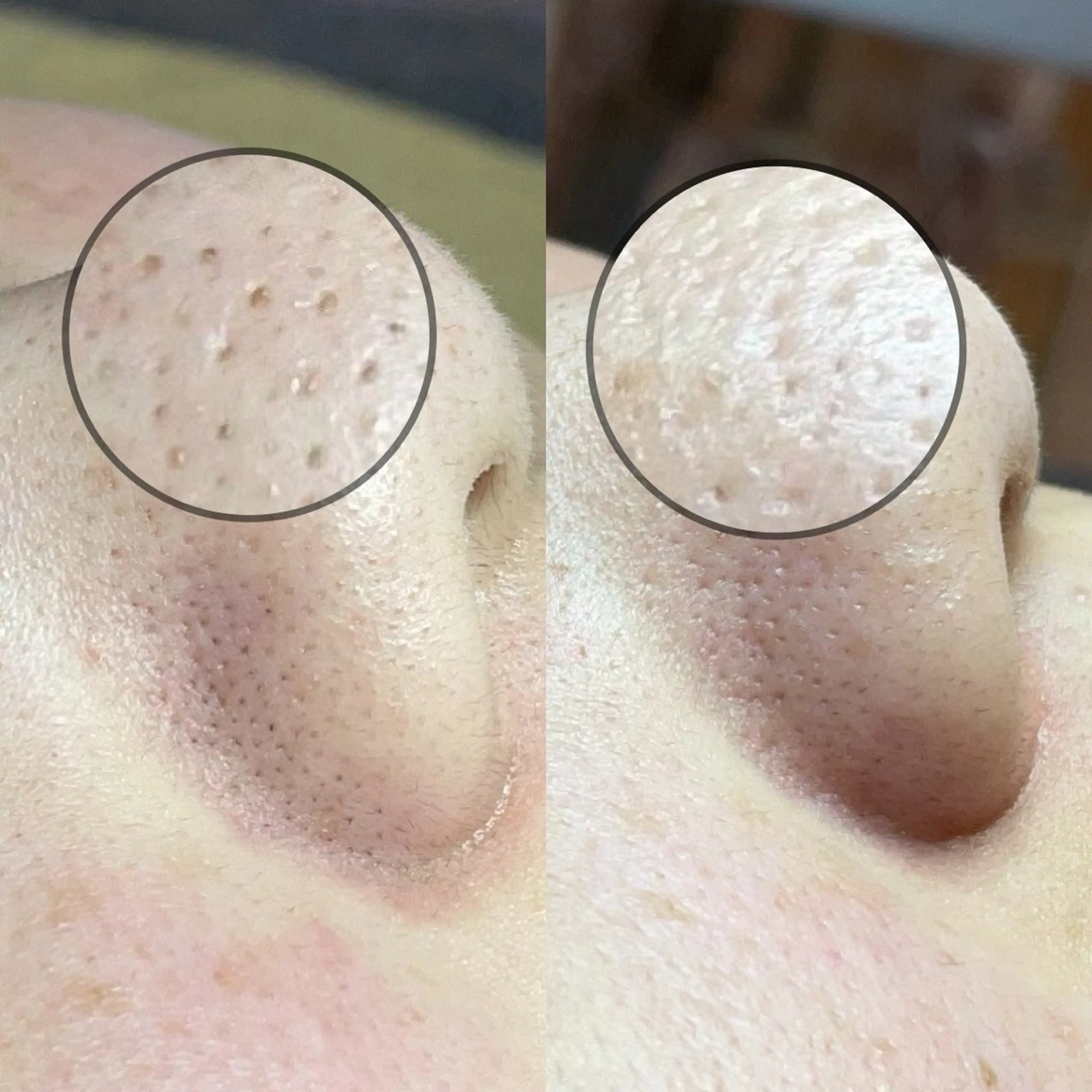 毛穴専門店MeMe.八千代店所属・\毛穴・頭皮/ のお悩みに特化💪のその他イメージ