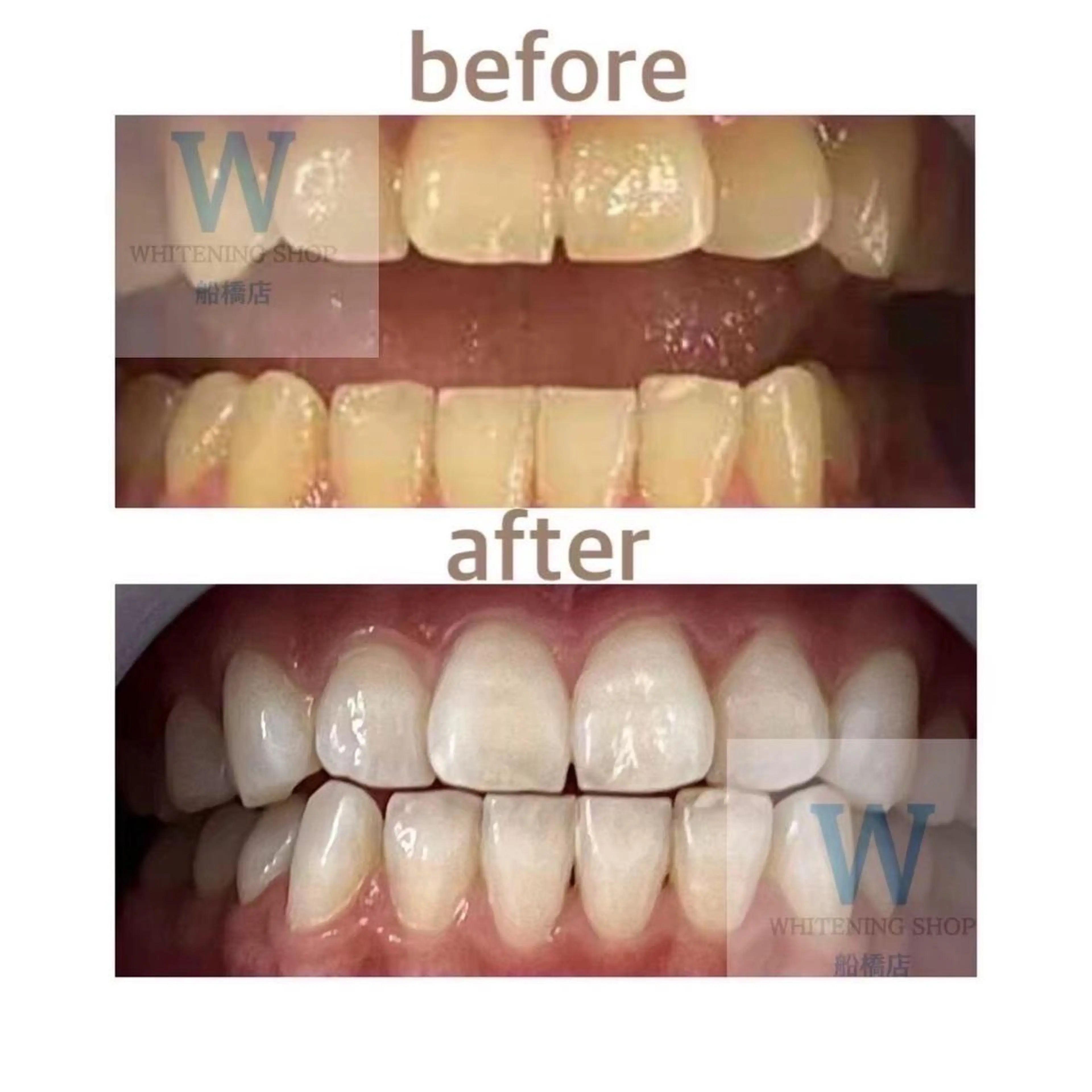 ホワイトニング ショップ船橋2号店のエステ・リラクイメージ