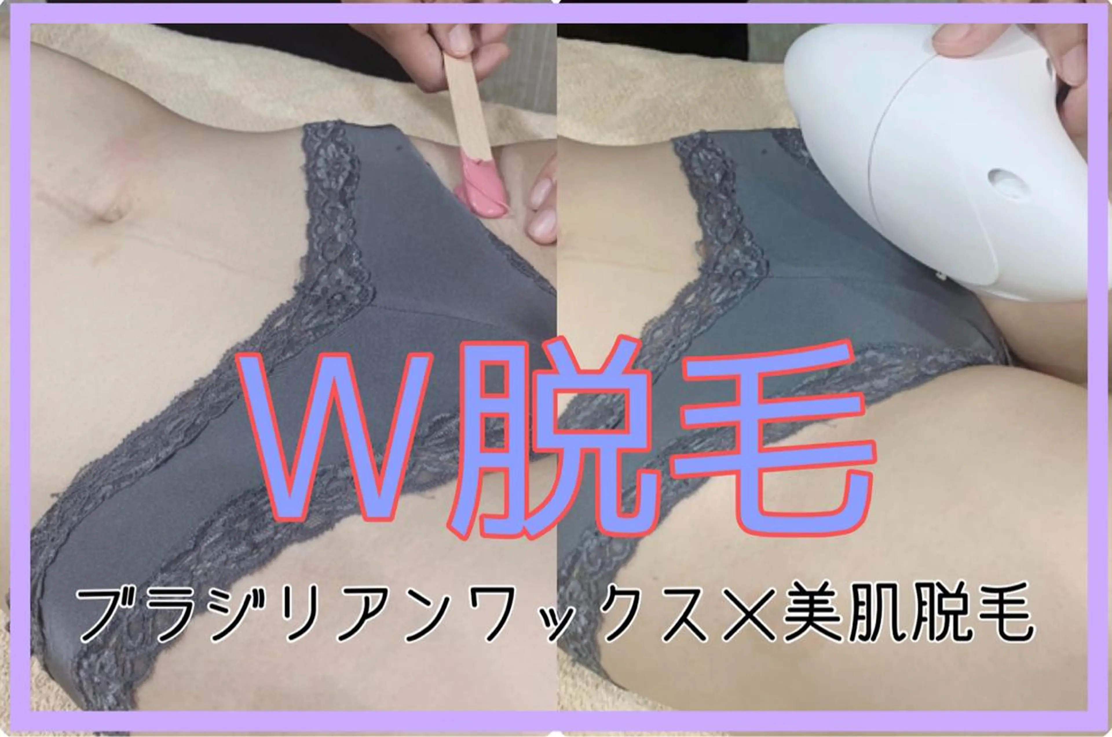 脱毛 垣田 ジョアアンジェ京橋のエステ・リラクイメージ