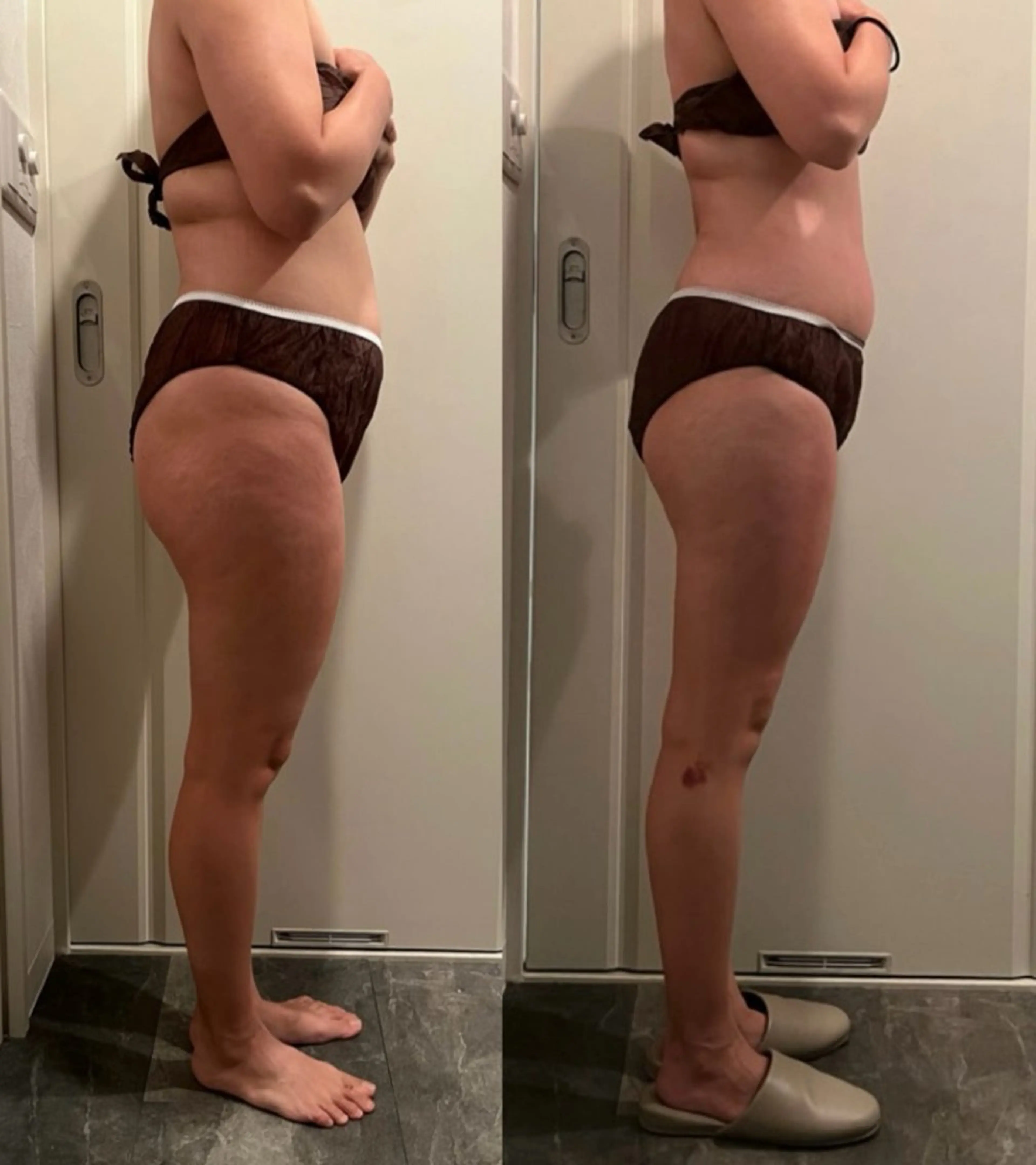 痩身/リラク 🎀KOZUKAのエステ・リラクイメージ