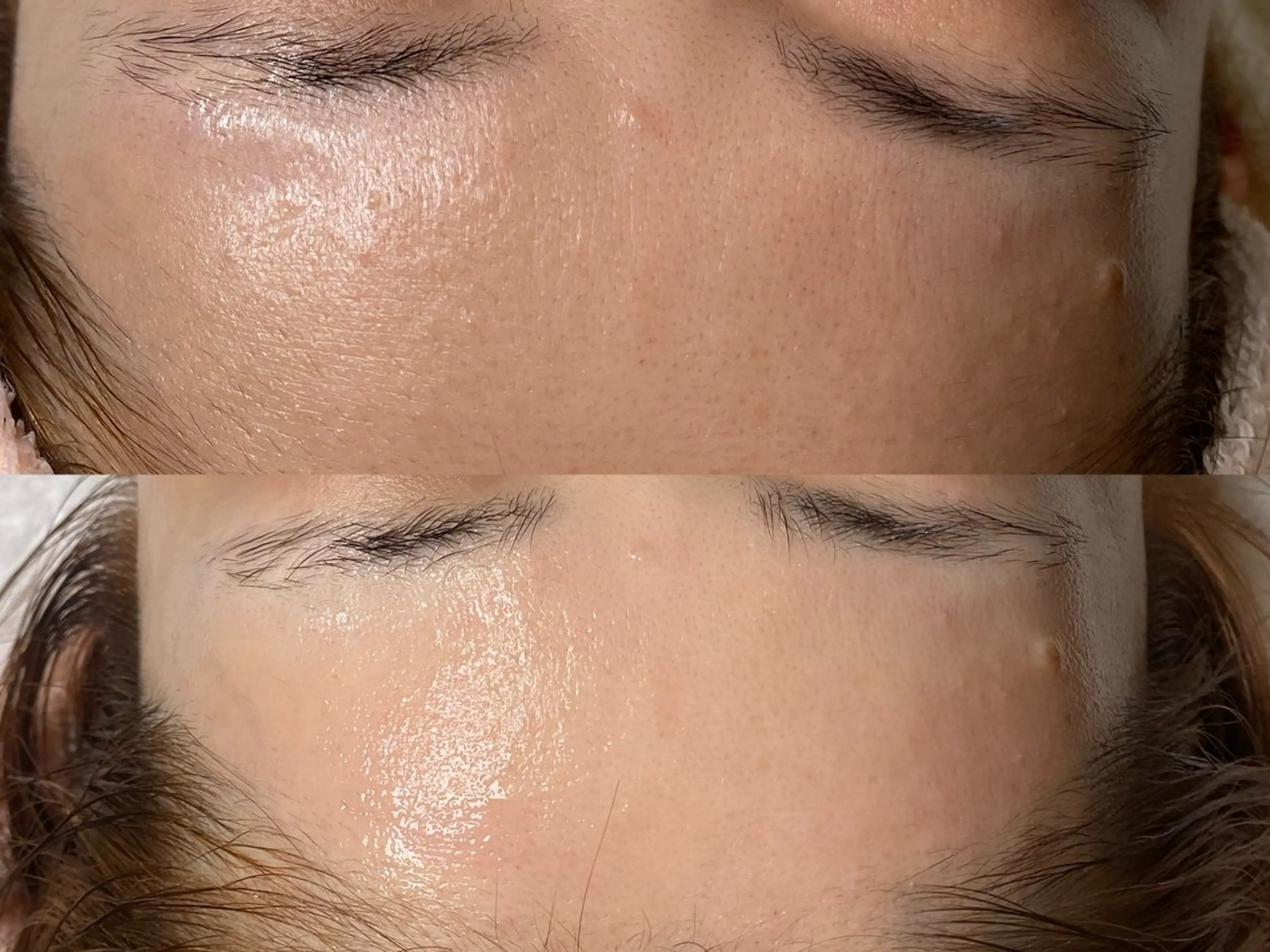 脱毛 田中 七海のエステ・リラクイメージ