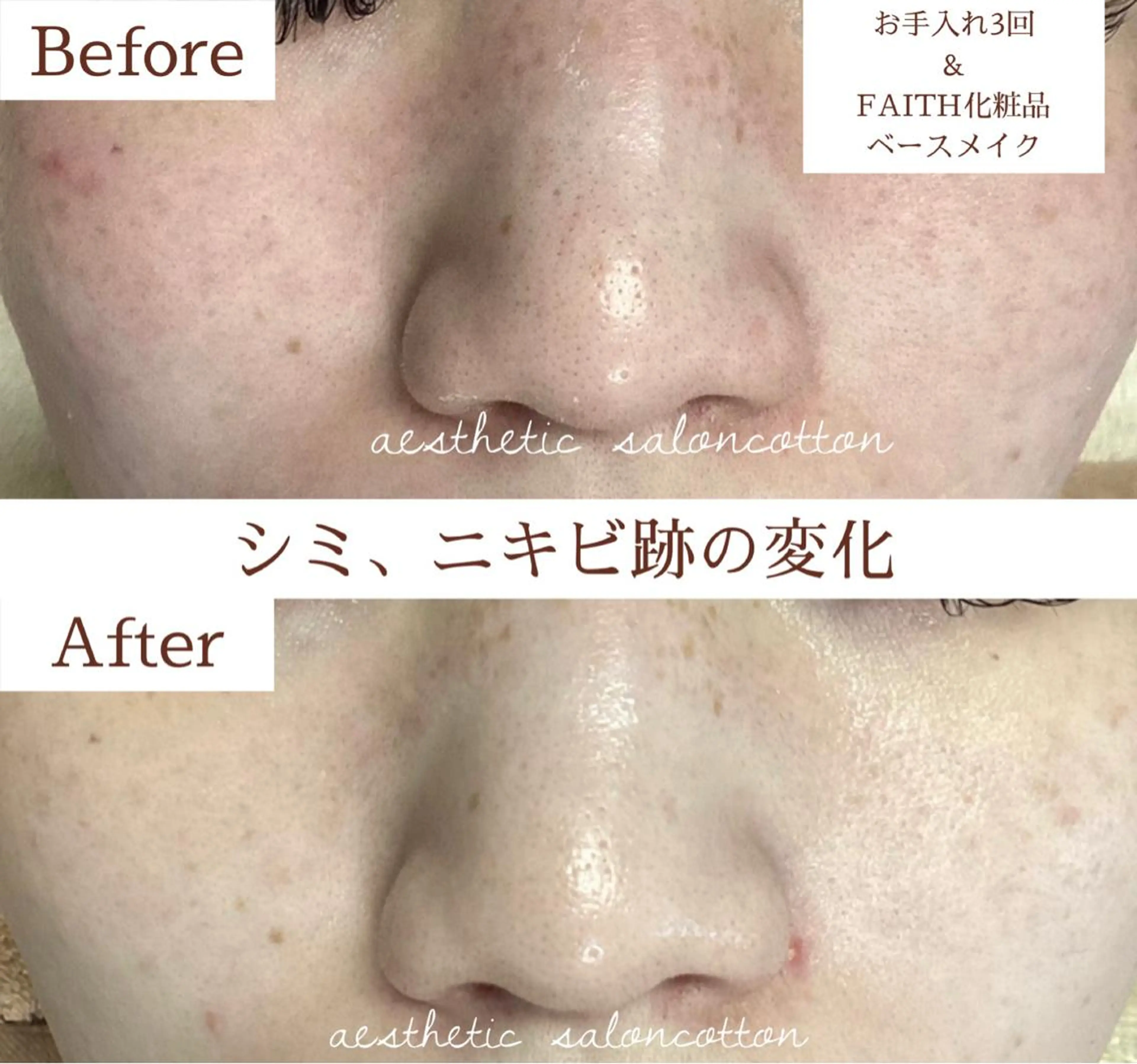 都度払い 肌質改善専門サロンのエステ・リラクイメージ