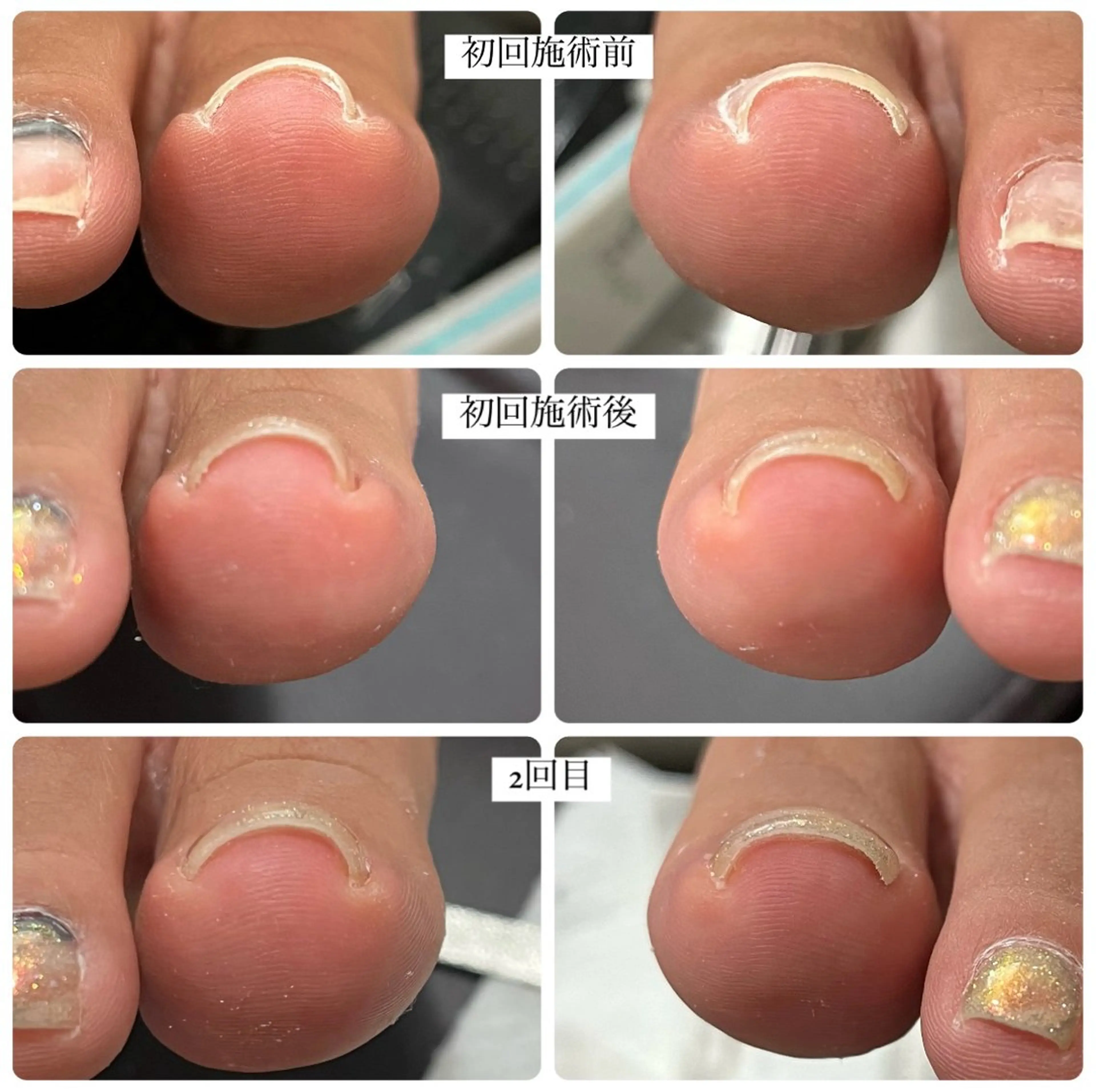 ネイル ジェルネイル フットネイル kupu所属・ネイルサロン kupuのネイルデザイン