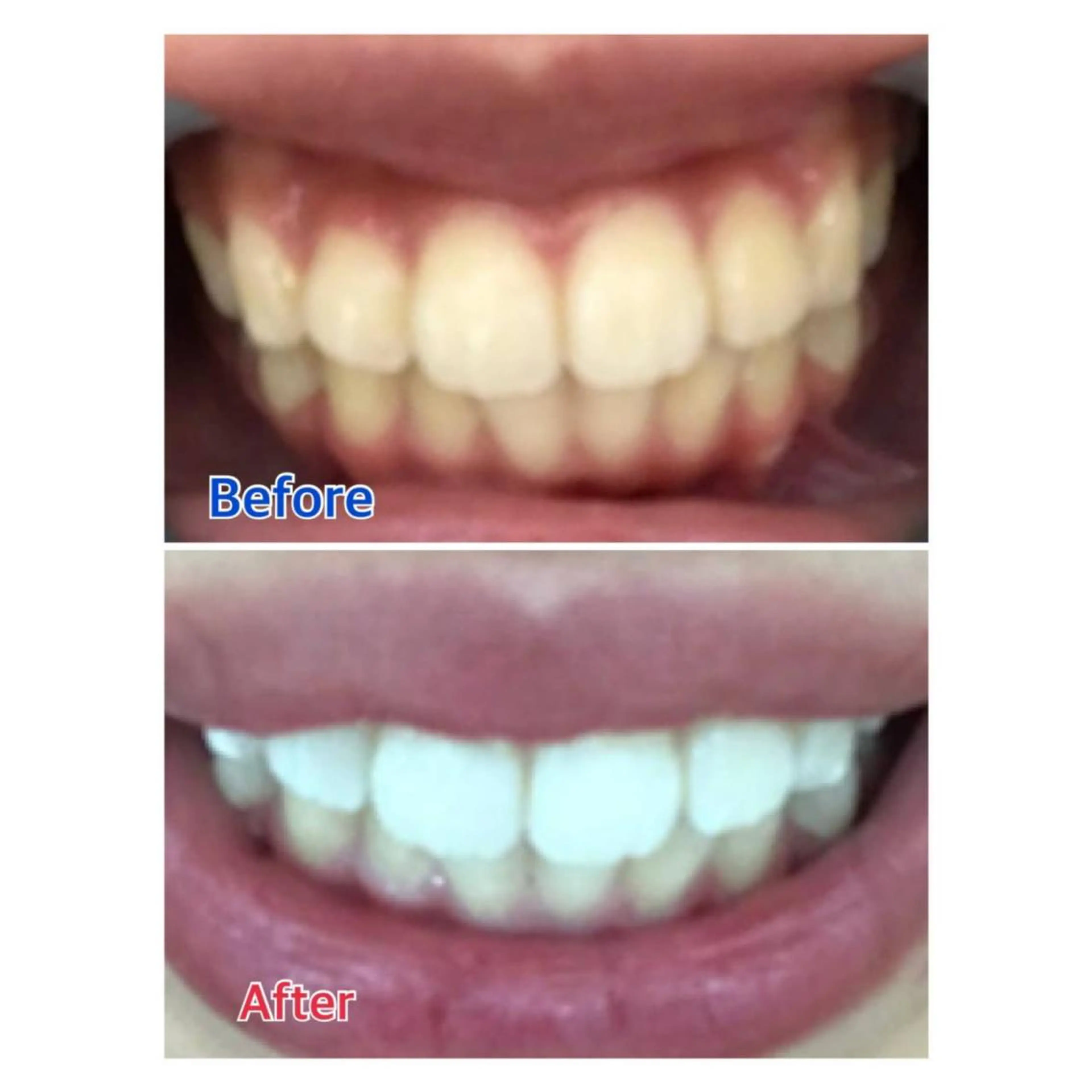 MBEAUTYSALON 千葉店・京成大久保所属・Melty 輝のその他イメージ