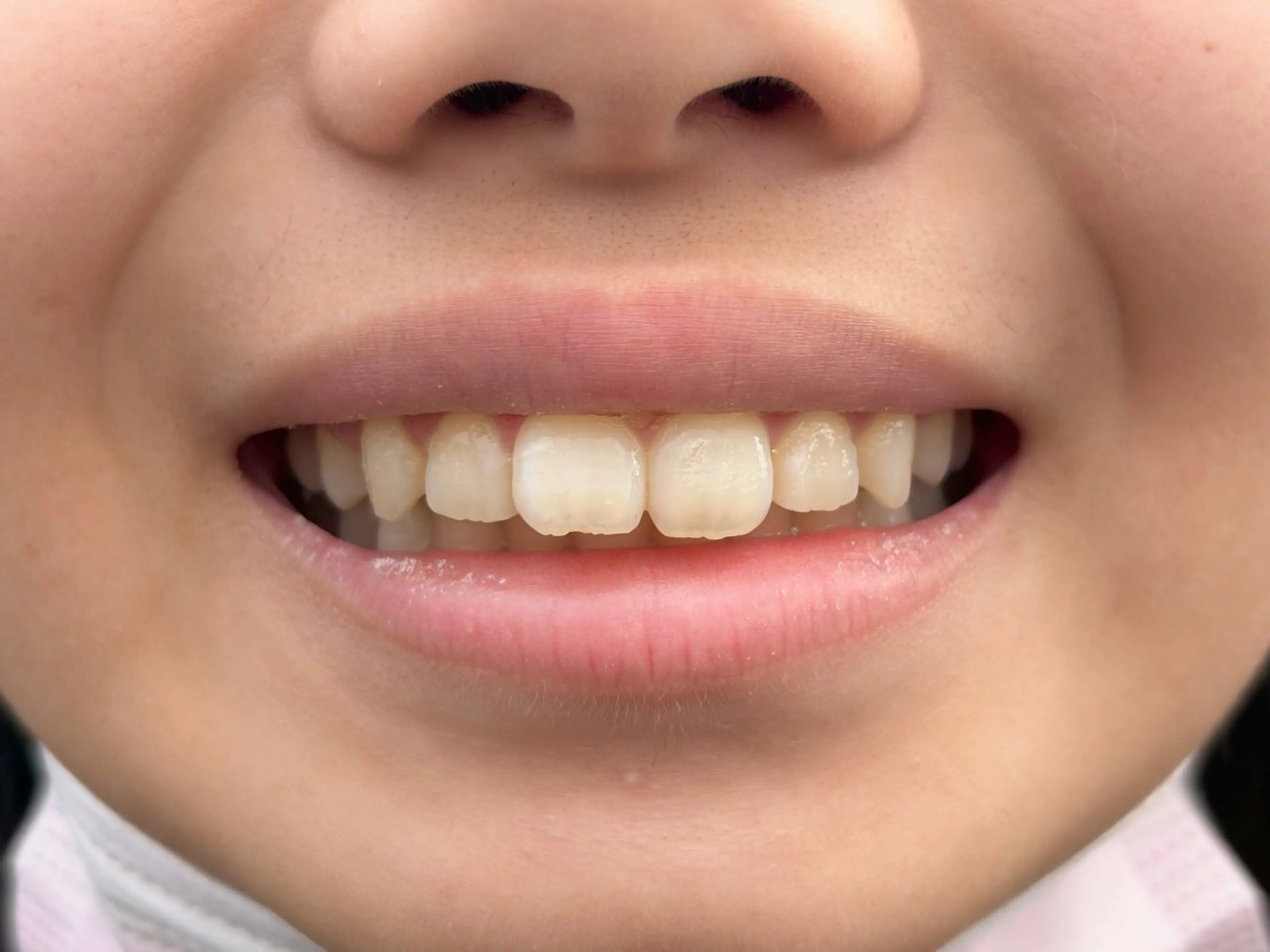 salon de hina所属・hina Aiのネイルデザイン