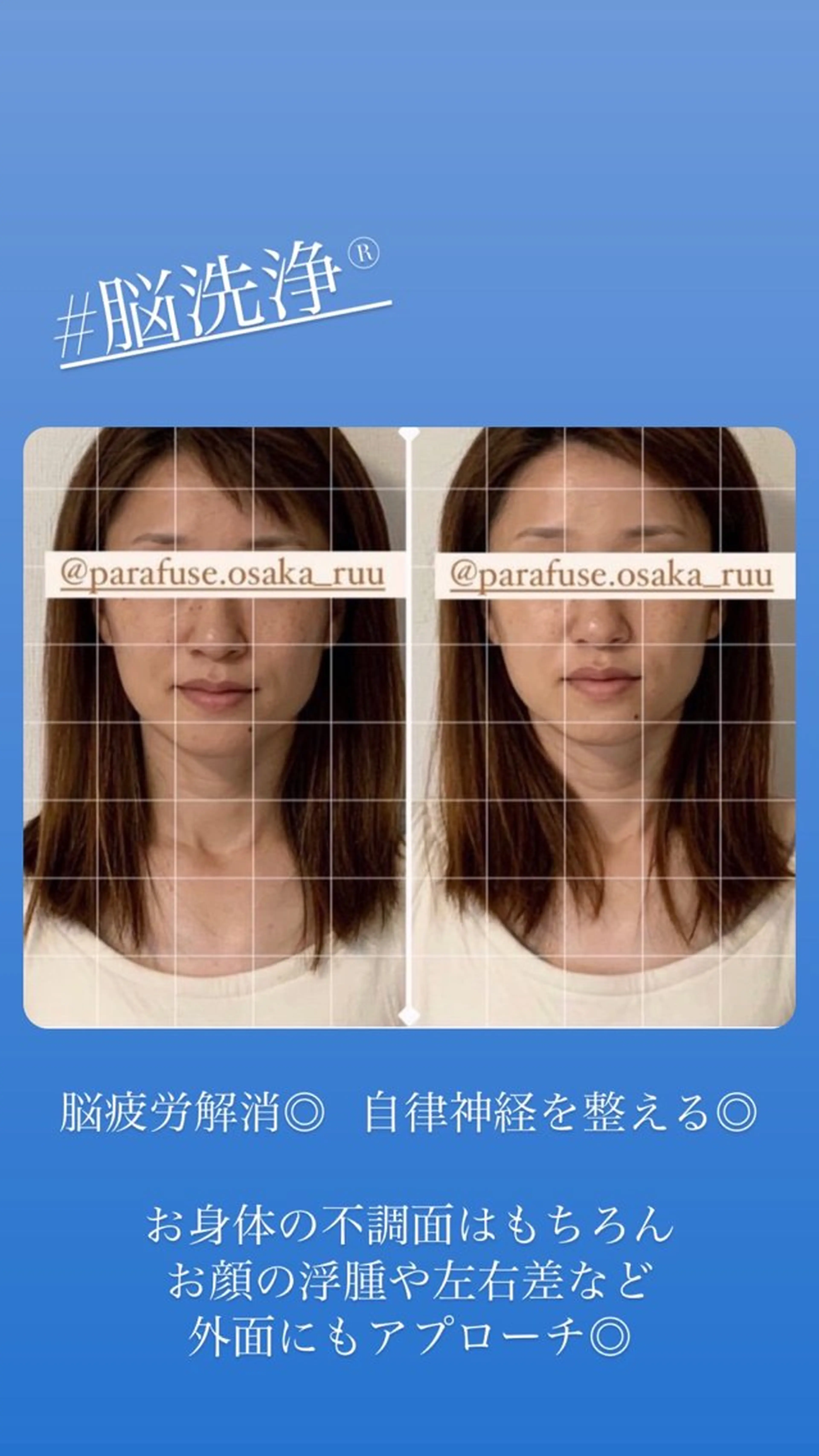 【頭痛、睡眠改善】 salon RUUのエステ・リラクイメージ