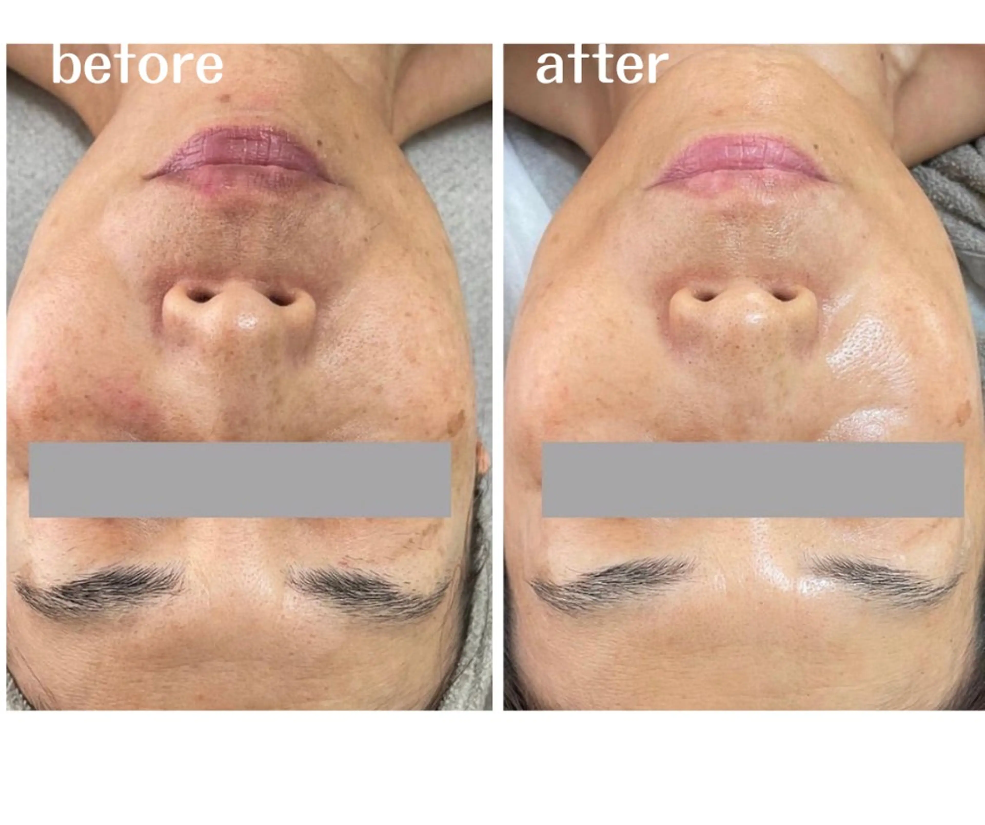 エステ aimee　肌質改善サロン【アイミー】所属・肌質改善サロン aimee｜アイミーのエステ・リラクイメージ