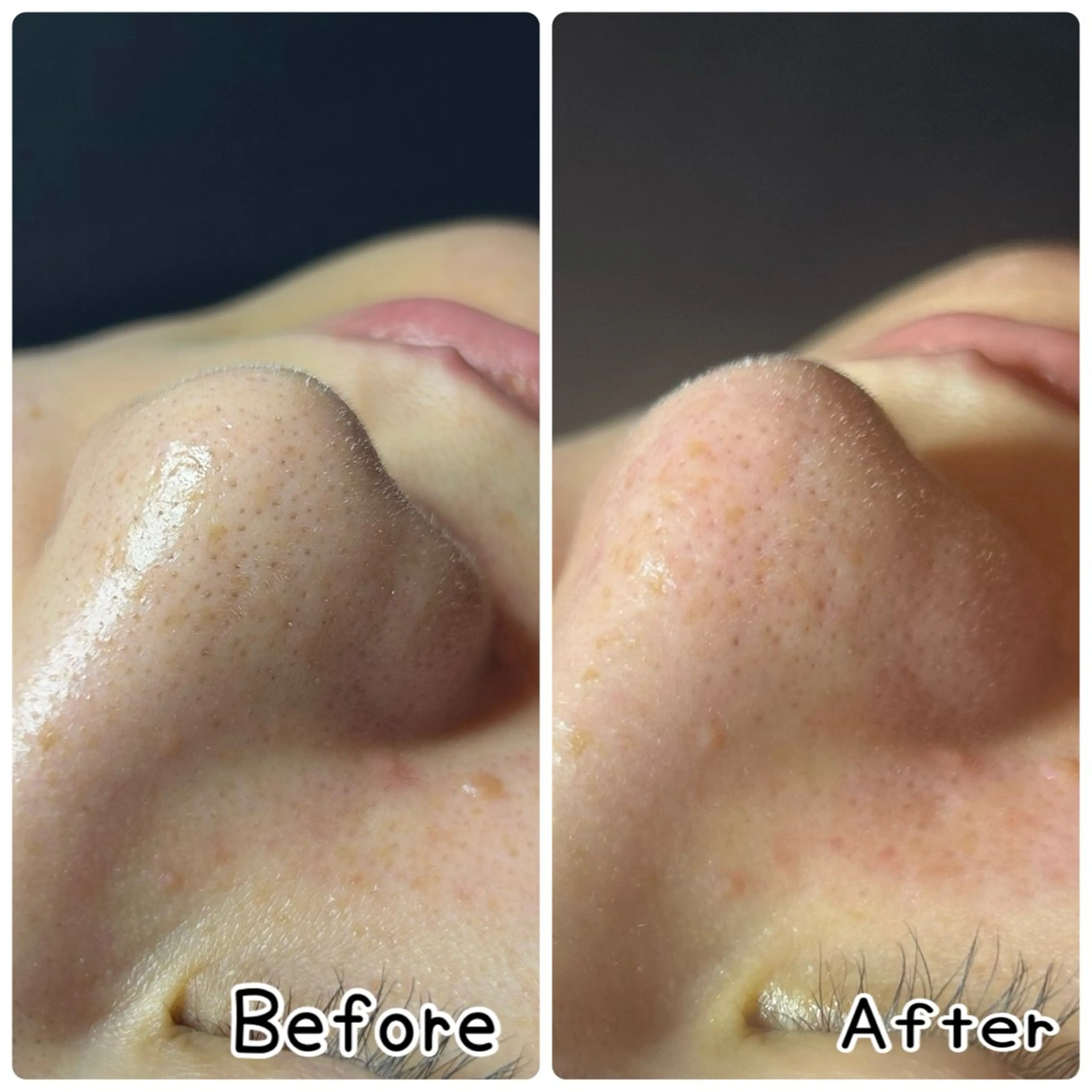 その他 鍼灸•マッサージサロンCalfa所属・《美肌･小顔》美容鍼 ＆マッサージ＊MEIのエステ・リラクイメージ