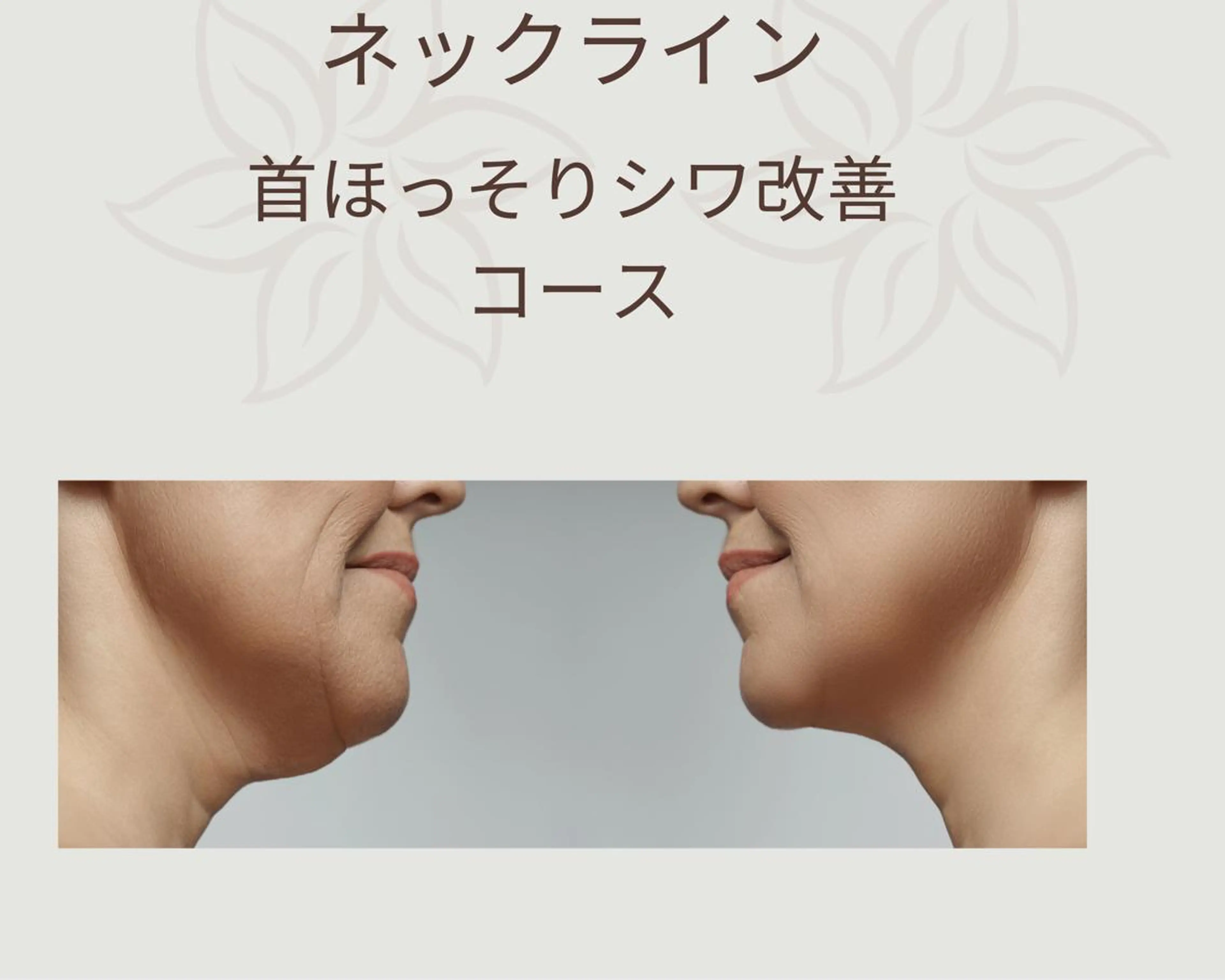 【整体ネックライン】　首ほっそりシワ引き締めコースの写真