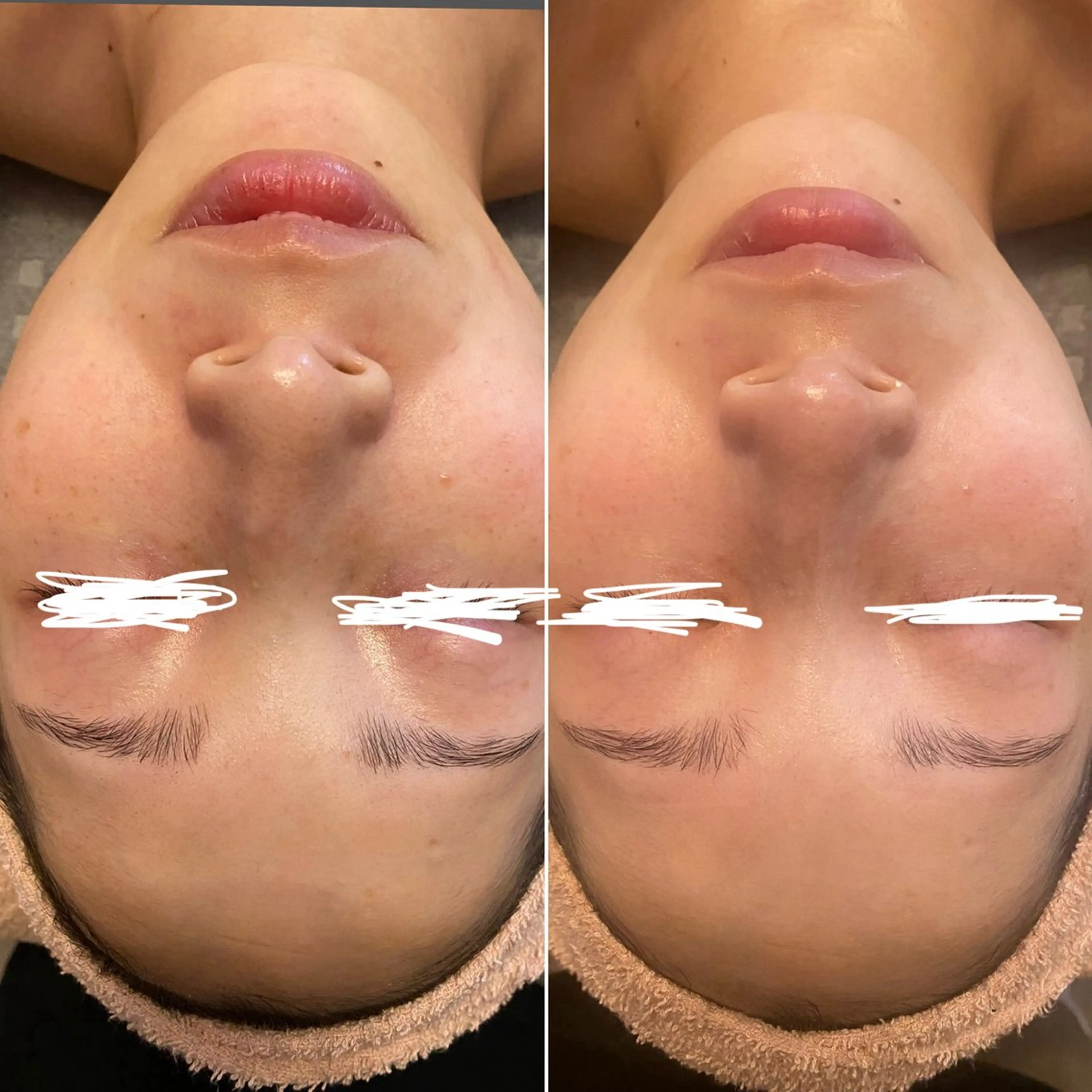 エステ Re Amply Minamiのエステ・リラクイメージ