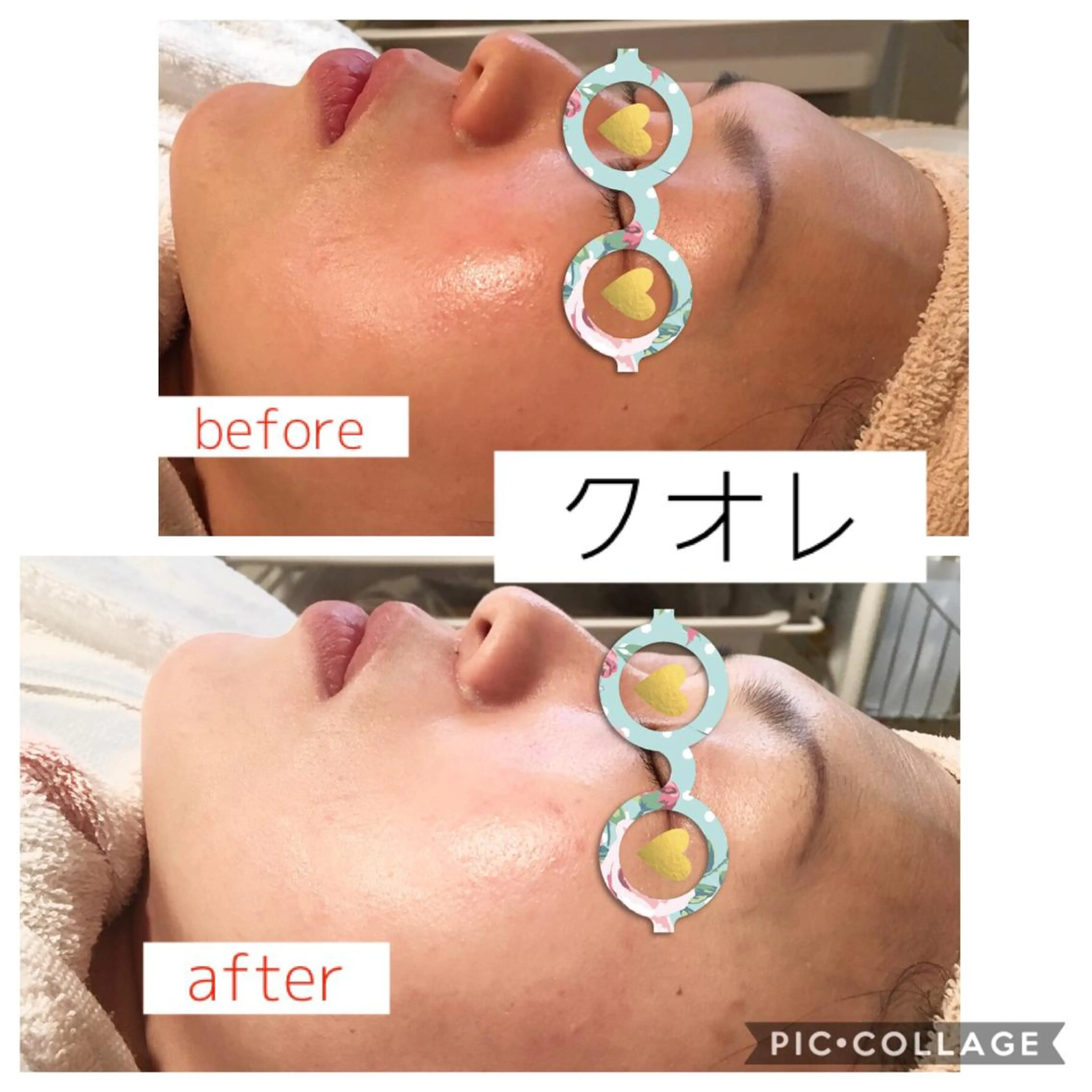 エステ 美肌専門salon クオレのエステ・リラクイメージ