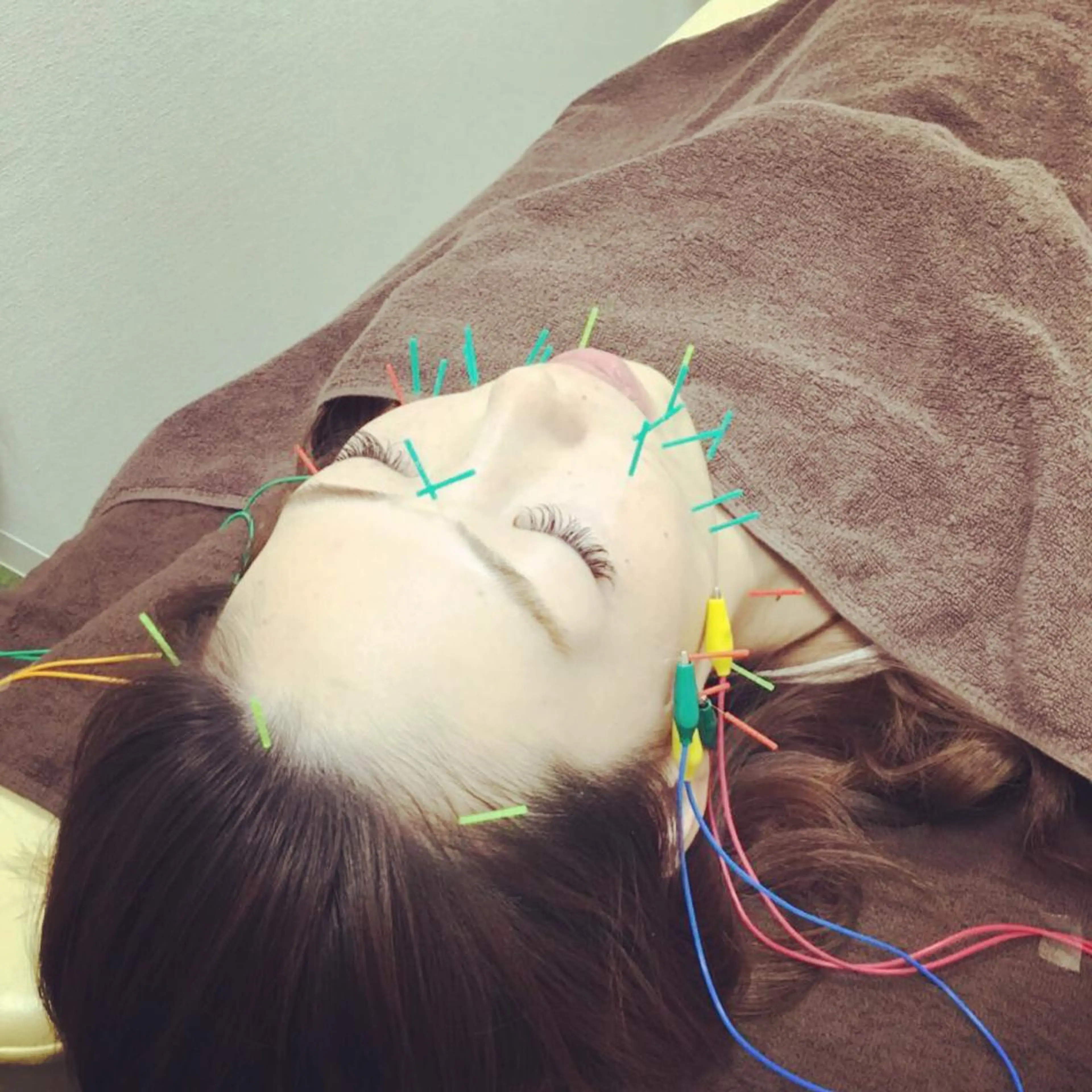 エステ リラク まごころ鍼灸整骨院所属・まごころ鍼灸整骨院 京王堀之内院のエステ・リラクイメージ