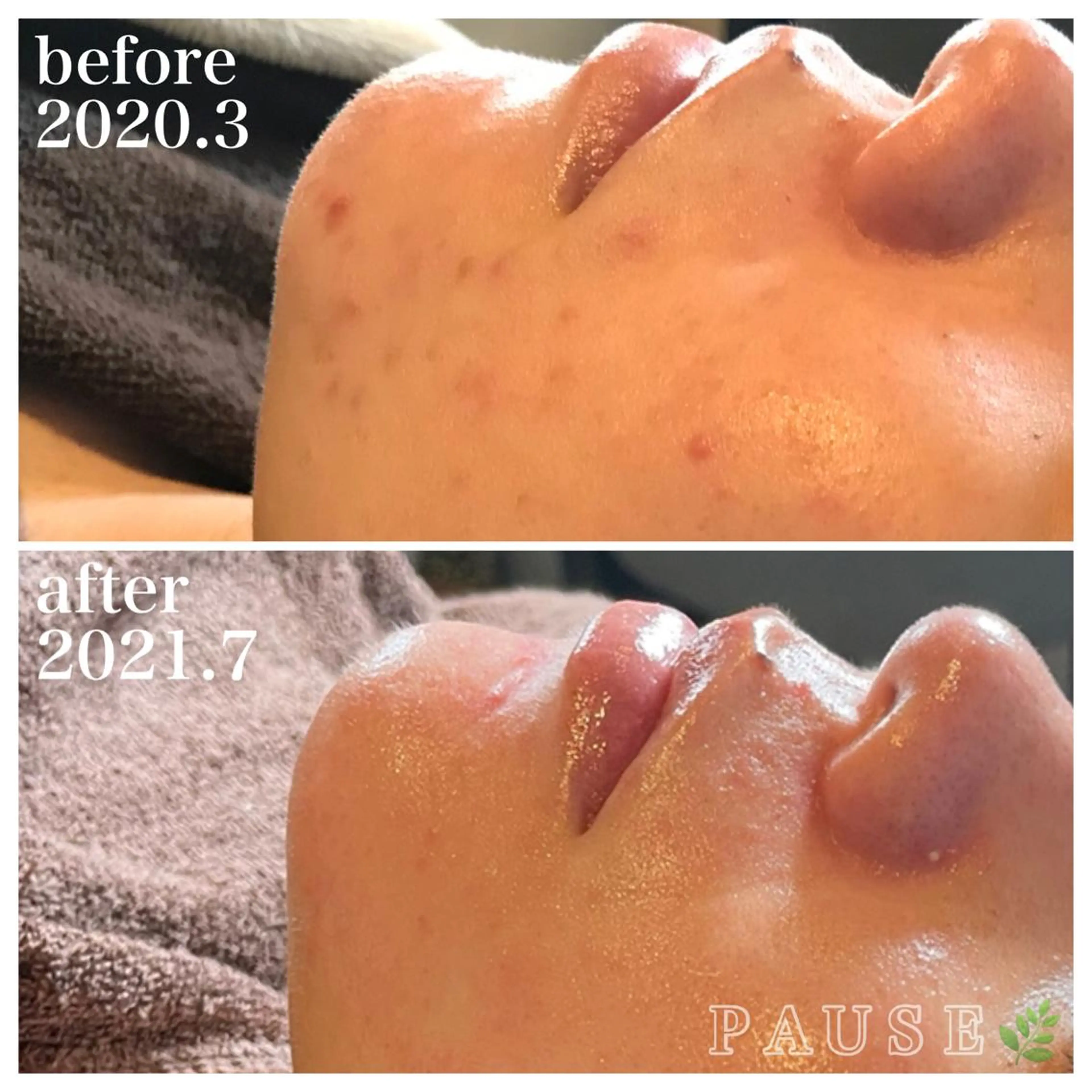 エステ 浜野 恵美のエステ・リラクイメージ