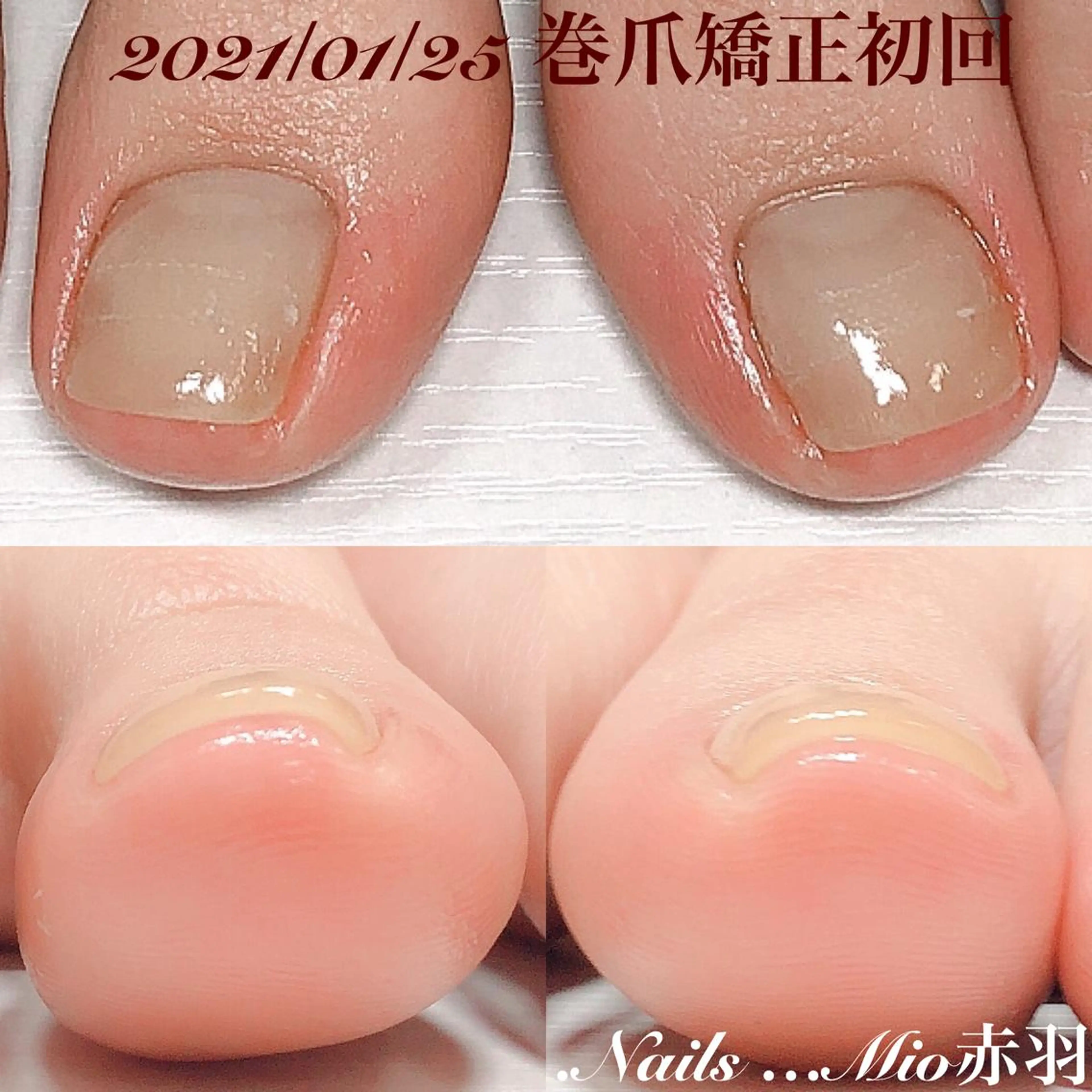 ネイル フットネイル フットネイル .Nails Mio 赤羽西ネイルサロンのネイルデザイン