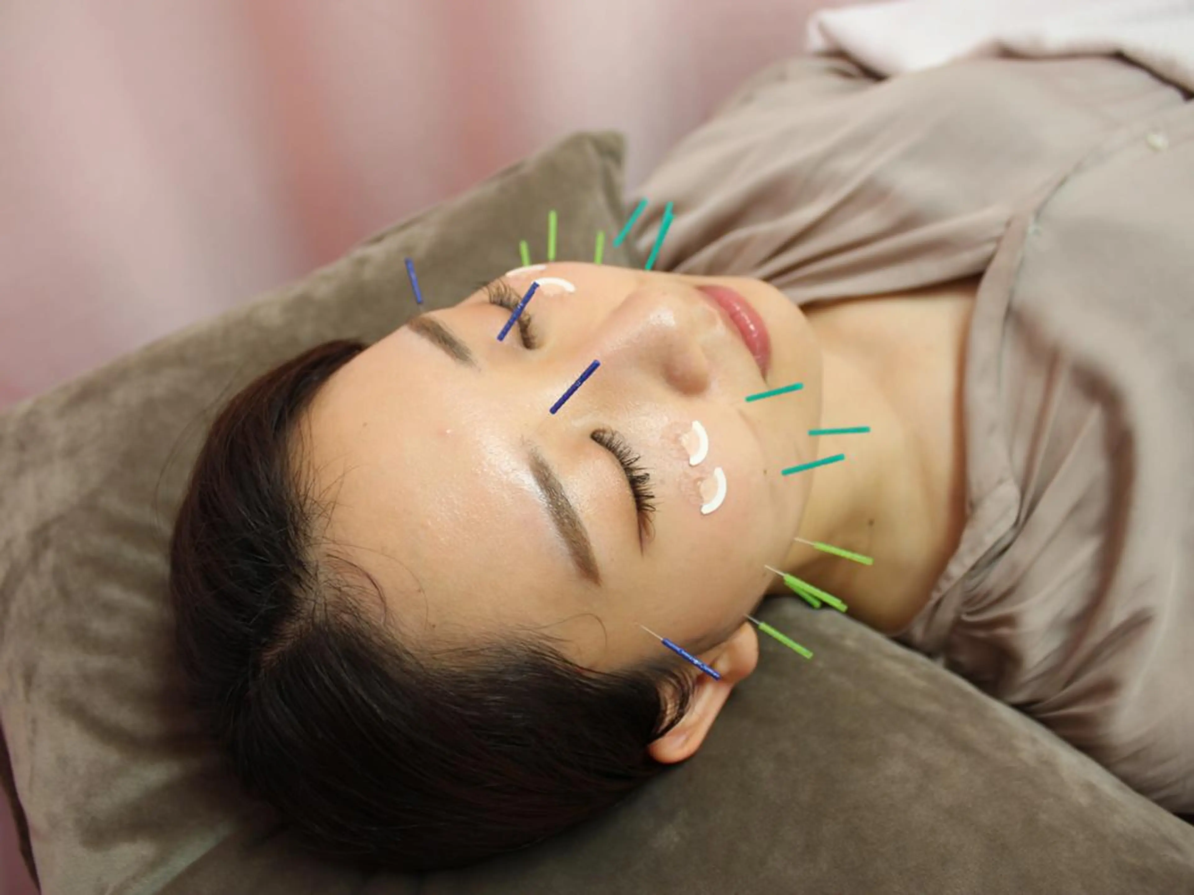 エステ リラク 同心整骨院 美容鍼・整体・小顔のエステ・リラクイメージ