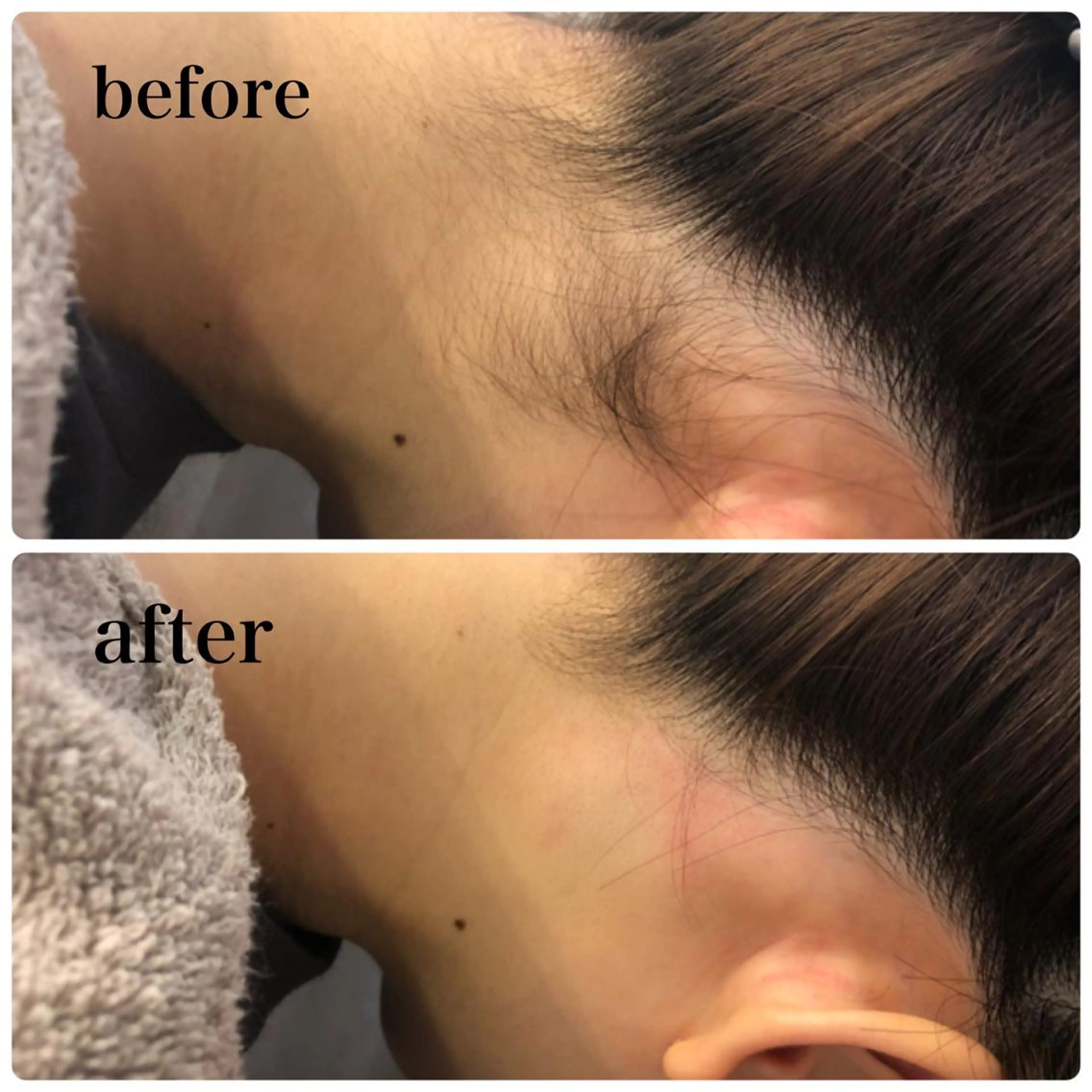 脱毛 美肌脱毛・ハーブピーリング専門店Larin la beaute所属・Larin la beauteのエステ・リラクイメージ