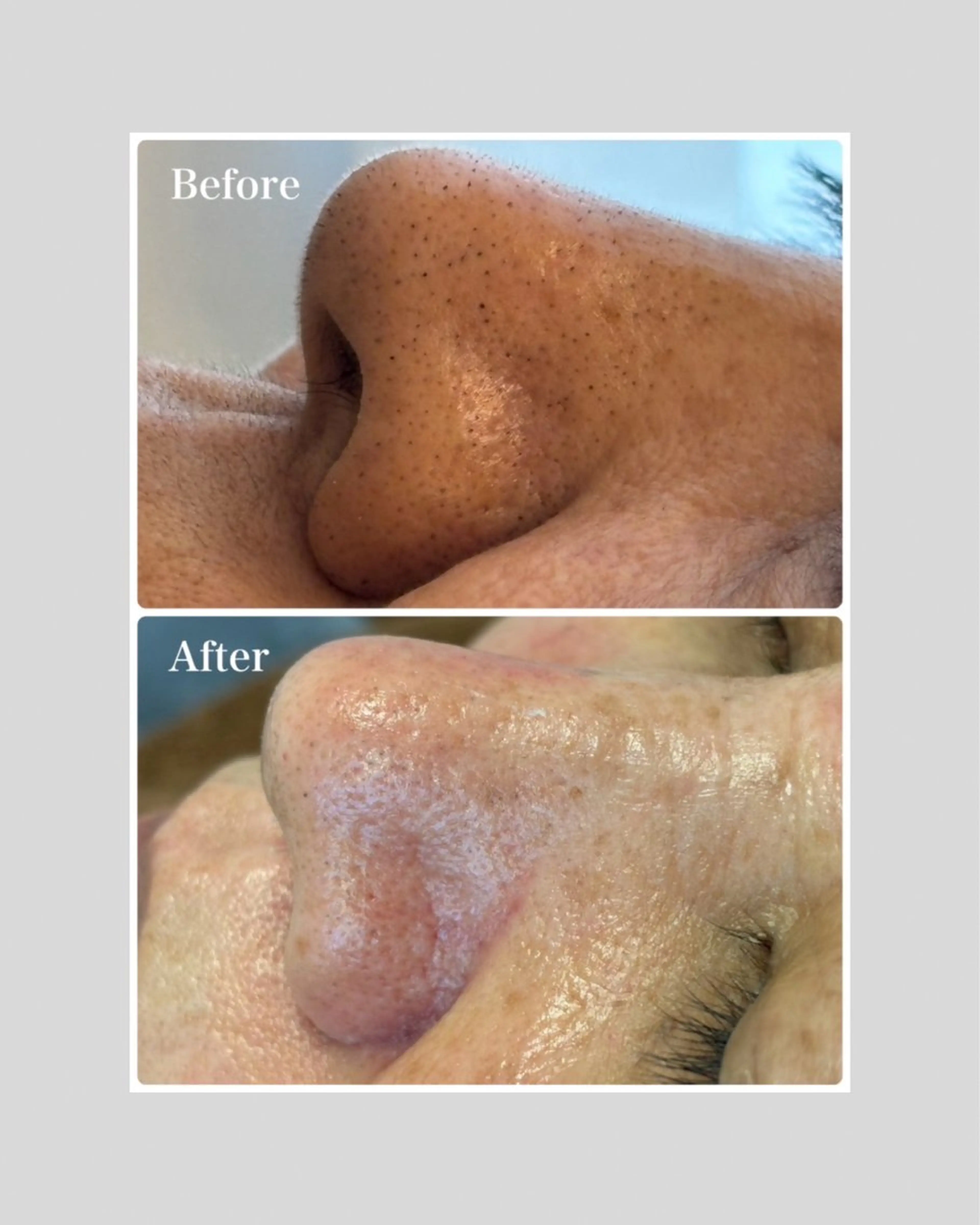 エステ リラク 韓国肌管理 【毛穴専科】のエステ・リラクイメージ