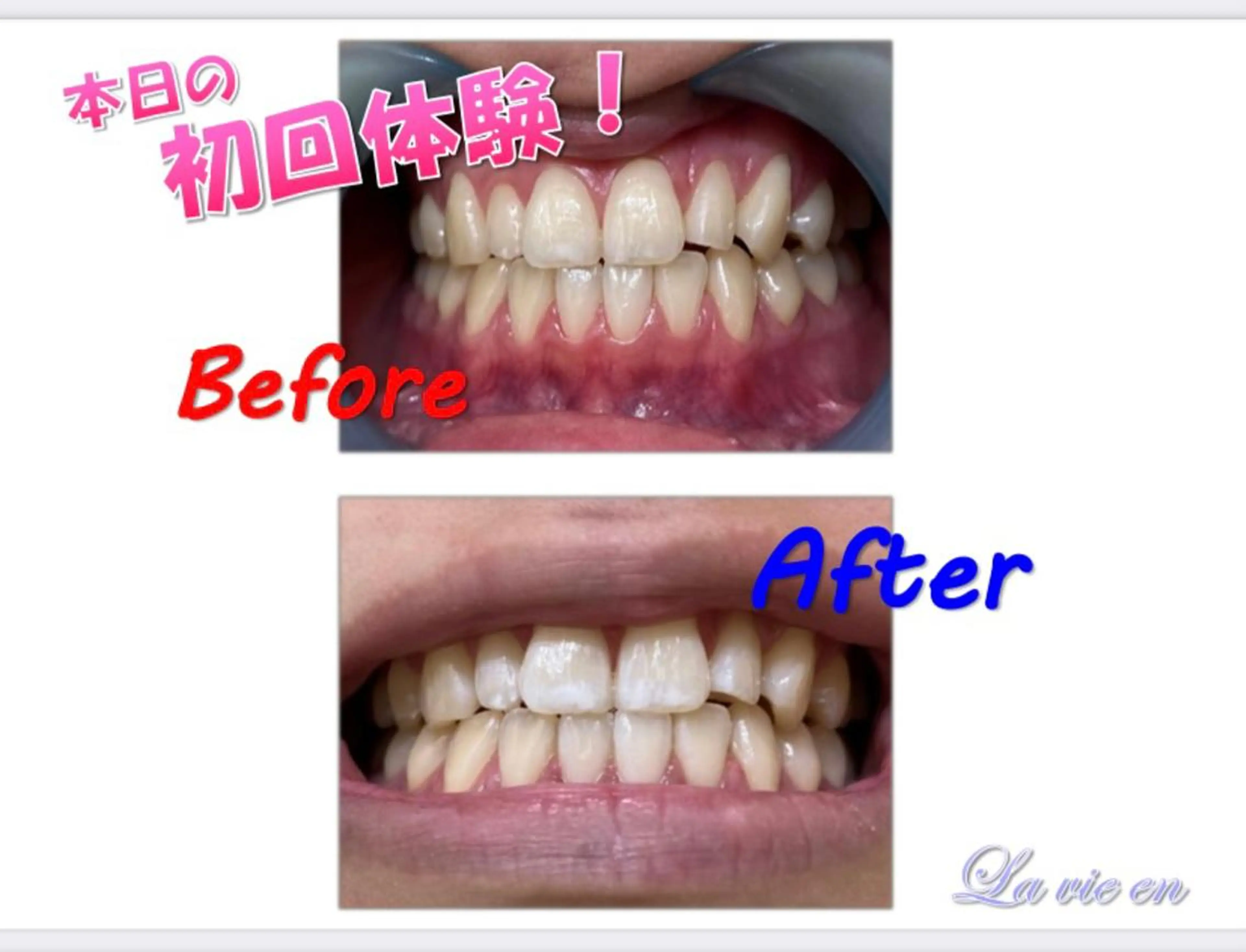 その他 セルフホワイトニングサロン　ラヴィアン所属・ホワイトニングサロン La vie enのその他イメージ