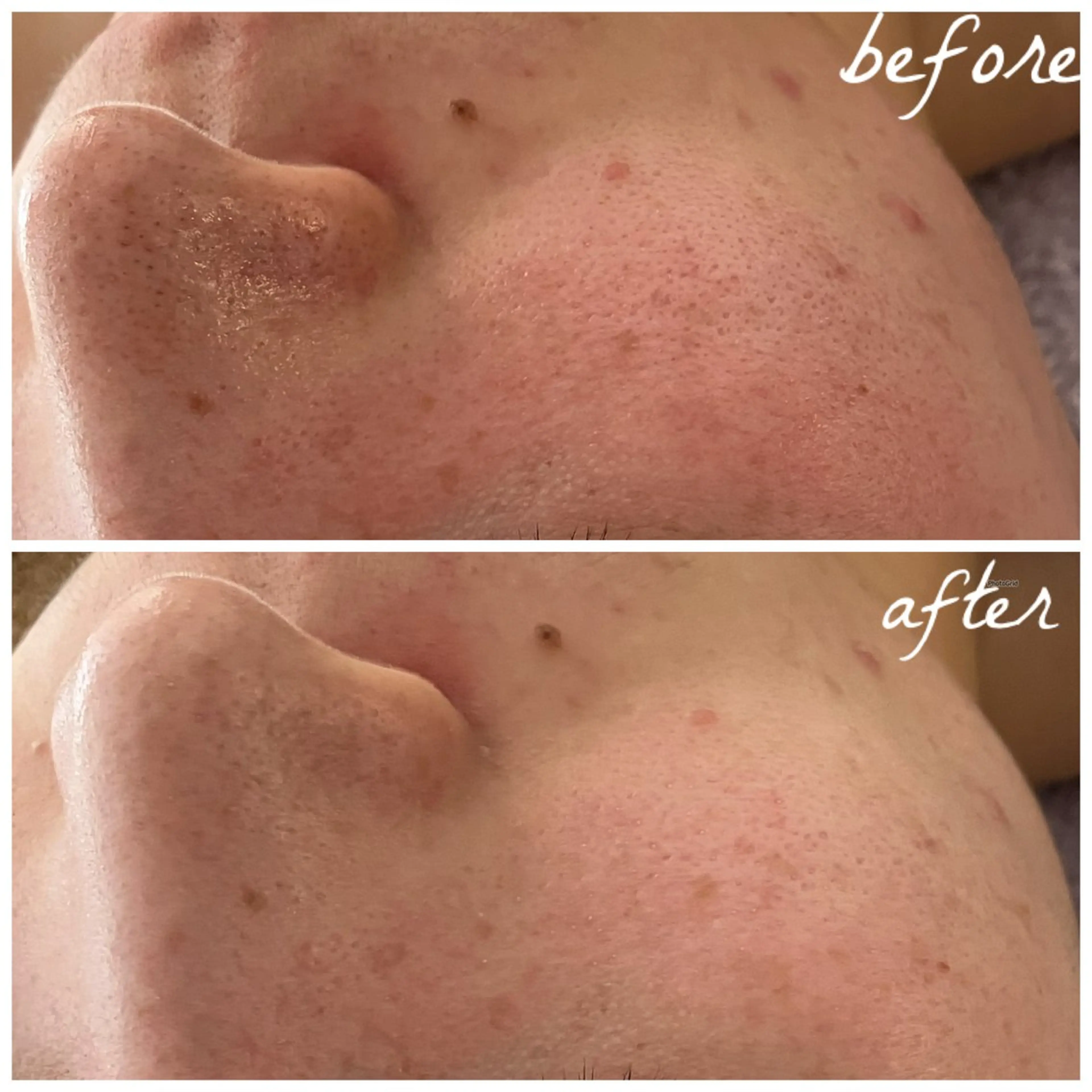 メンズ エステ メナード岐阜茜部 杉浦のエステ・リラクイメージ