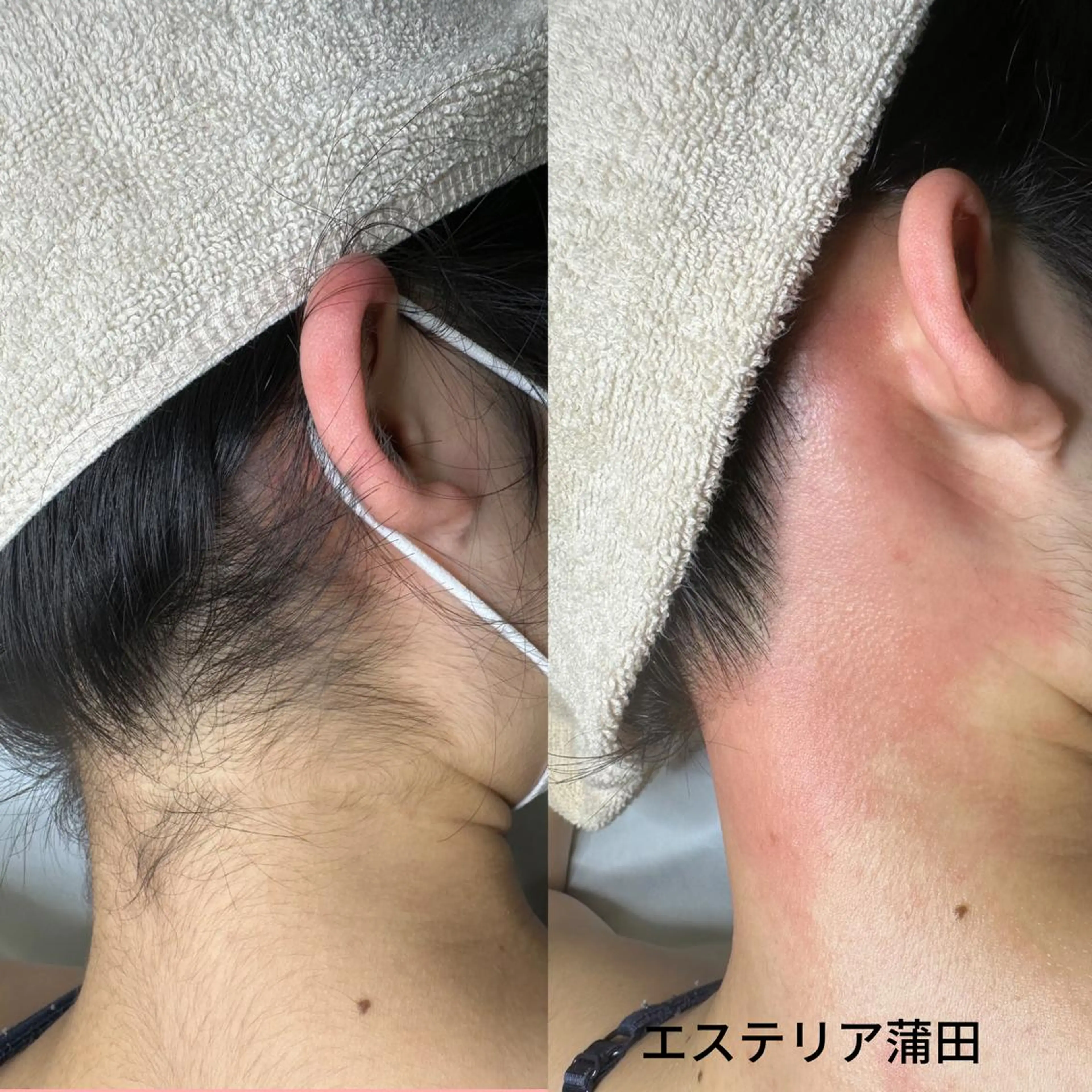 脱毛 WAX＆光脱毛 ESTHERIAのエステ・リラクイメージ