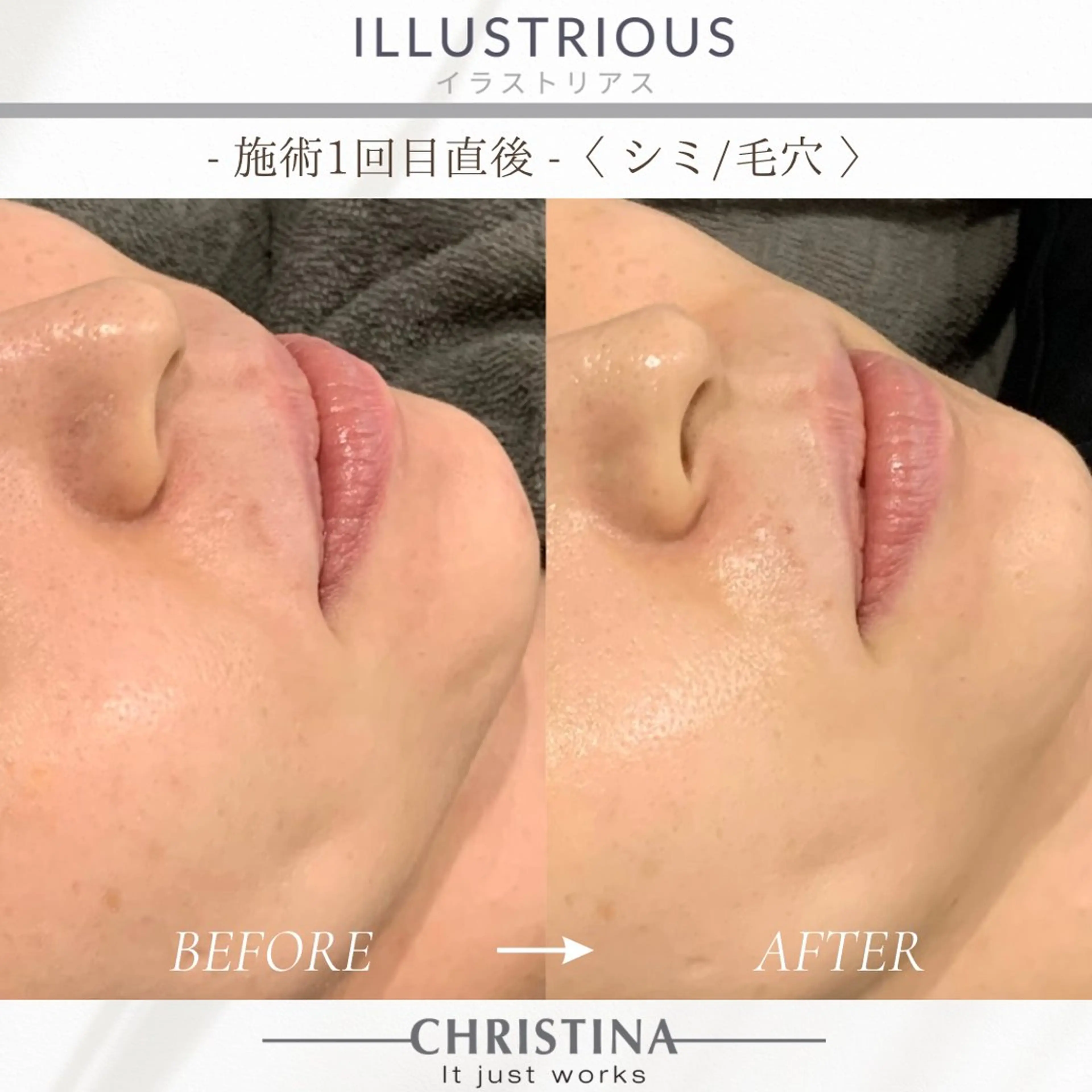 THE SALON -esme-のマツエク・マツパデザイン