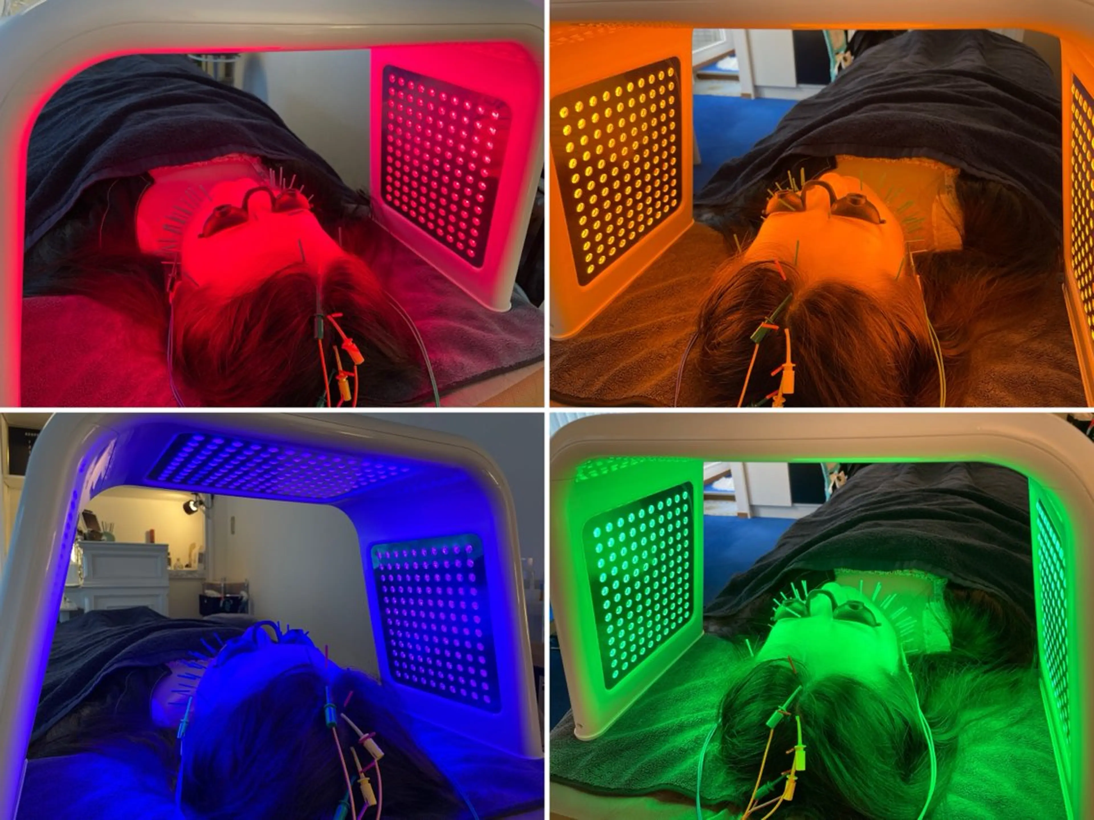 エステ リラク 小顔美容鍼専門サロン 渋谷YZのエステ・リラクイメージ