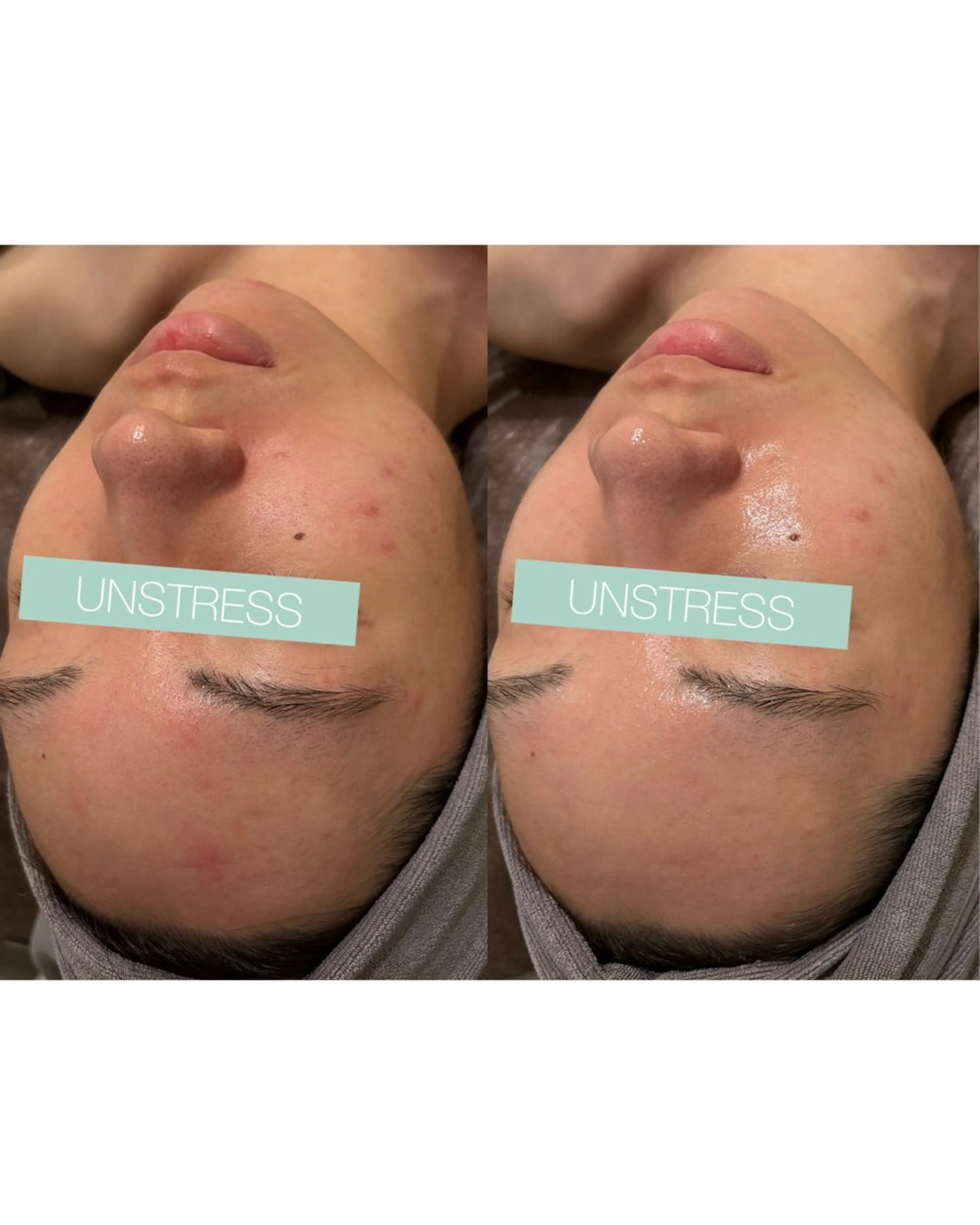 ☆痩身/小顔☆ 結果出します☆のエステ・リラクイメージ